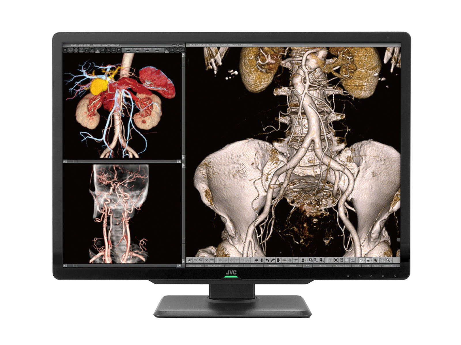 JVC Totoku CL-S600 6MP 30" Color LED General Radiology PACS Display (CL-S600) Monitors.com 