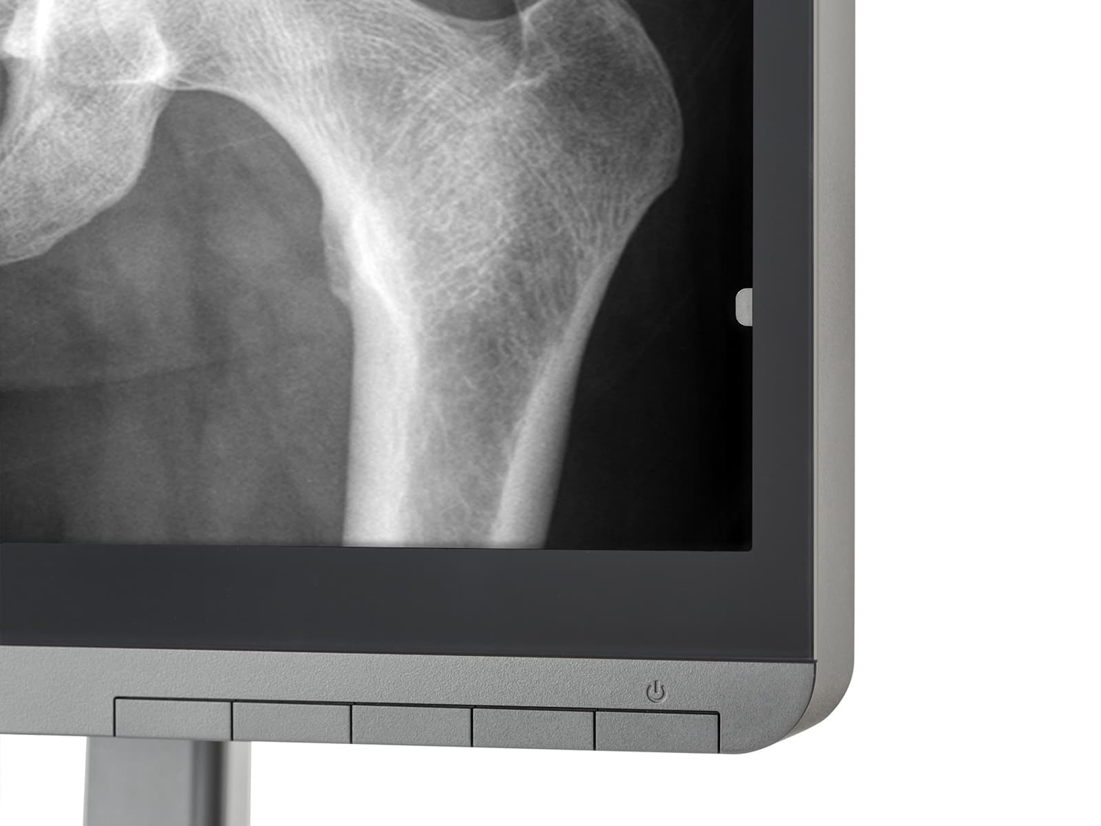 JVC Totoku CL-S500 5MP 21" Color LED Mammo 3D-DBT Breast Imaging Display (CL-S500)