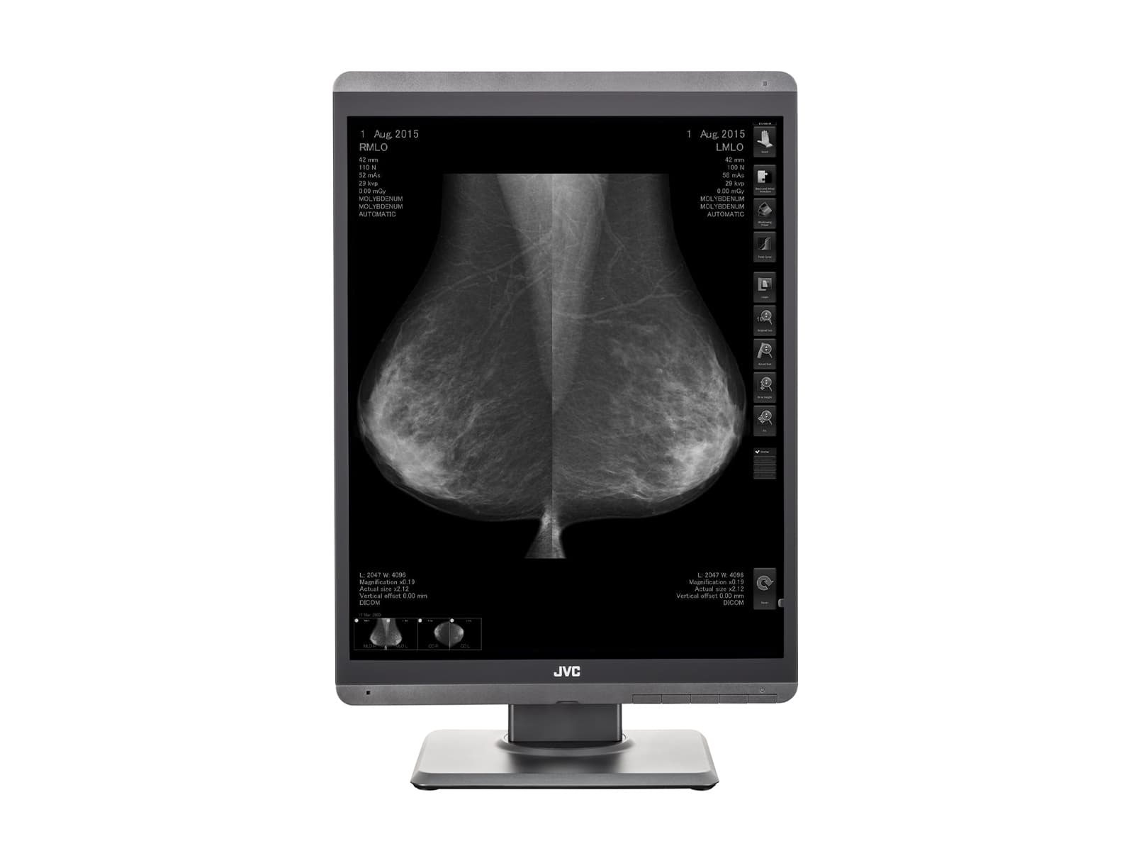 JVC Totoku MS-S500 5MP 21" Mammo 3D-DBT Grayscale LED Breast Imaging Display (MS-S500) Monitors.com 