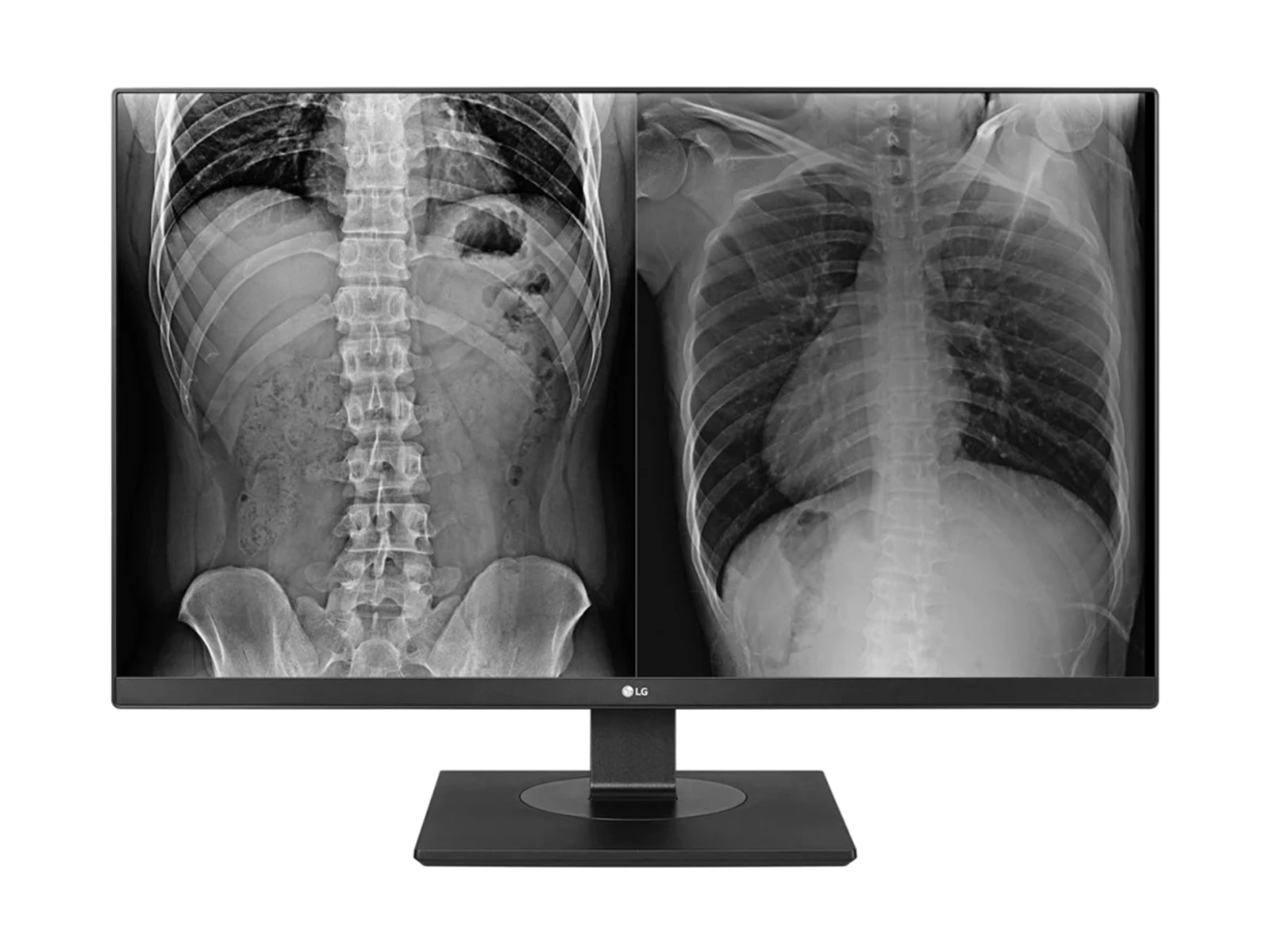 LG 27HJ713C 8MP 27" Color Clinical Review Display Monitor (27HJ713C-B)