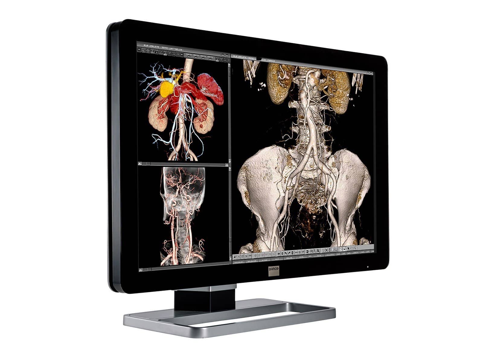 Barco Coronis Fusion MDCC-4330 4MP 30" Color LED General Radiology PACS Display