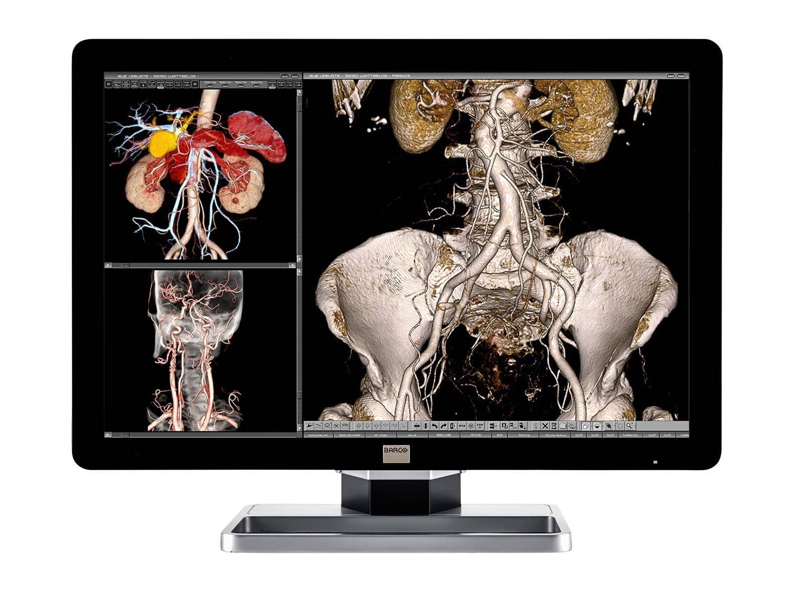 Barco Coronis Fusion MDCC-4330 4MP 30" Color LED General Radiology PACS Display