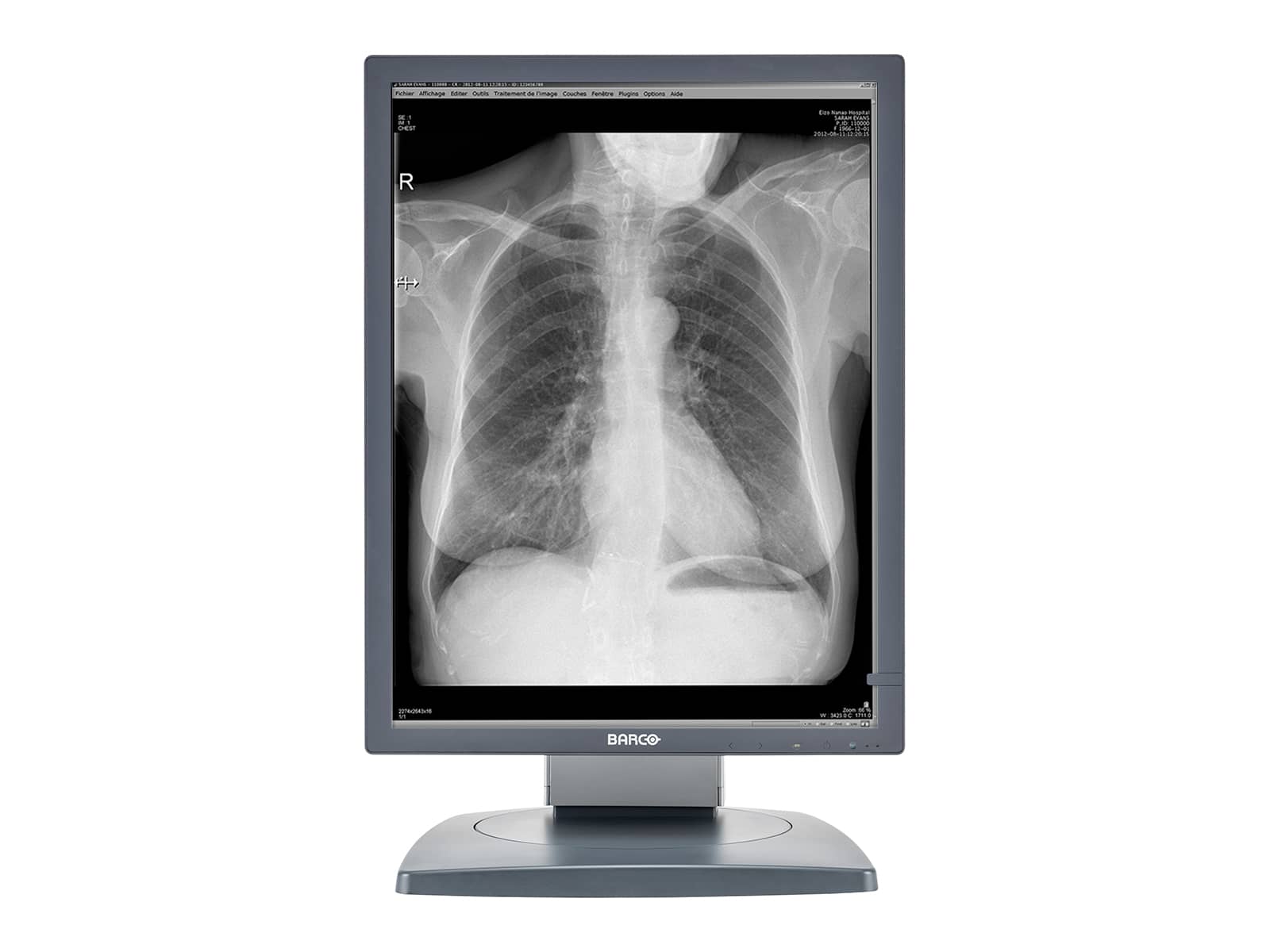 Barco Coronis MDCG-3120 3MP 20.8" Grayscale General Radiology Diagnostic Display Monitors.com 