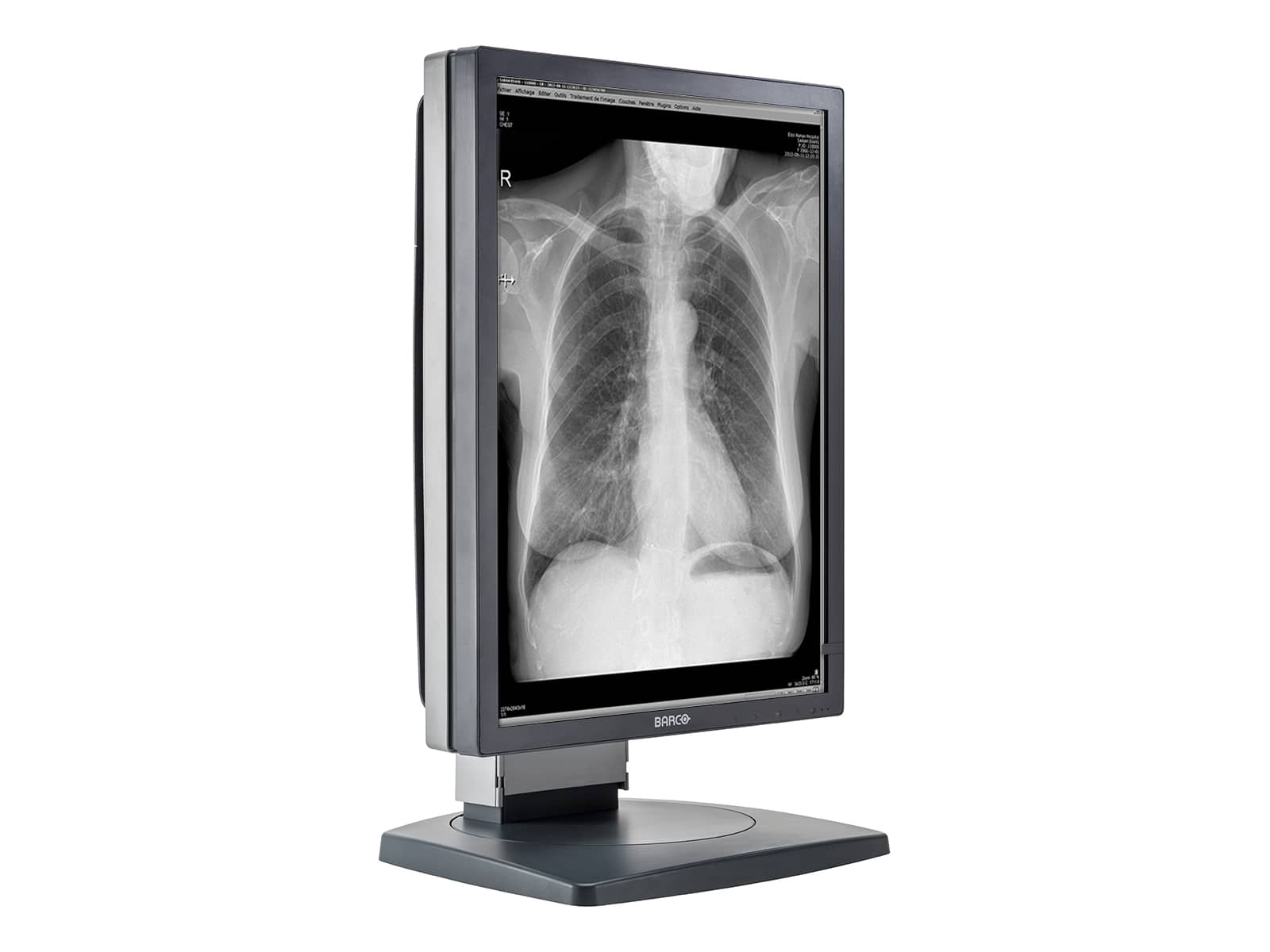 Barco Coronis MDCG-3120 3MP 20.8" Grayscale General Radiology Diagnostic Display Monitors.com 