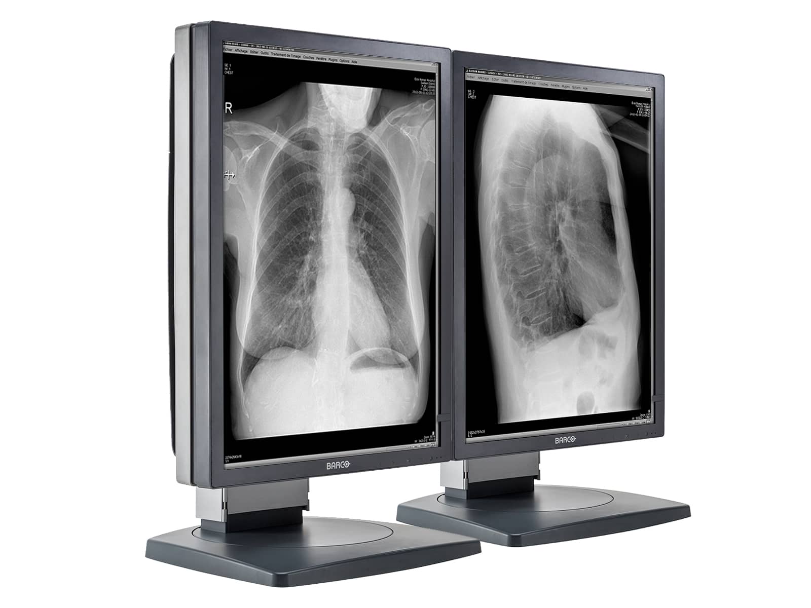 Barco Coronis MDCG-3120 3MP 20.8" Grayscale General Radiology Diagnostic Display Monitors.com 