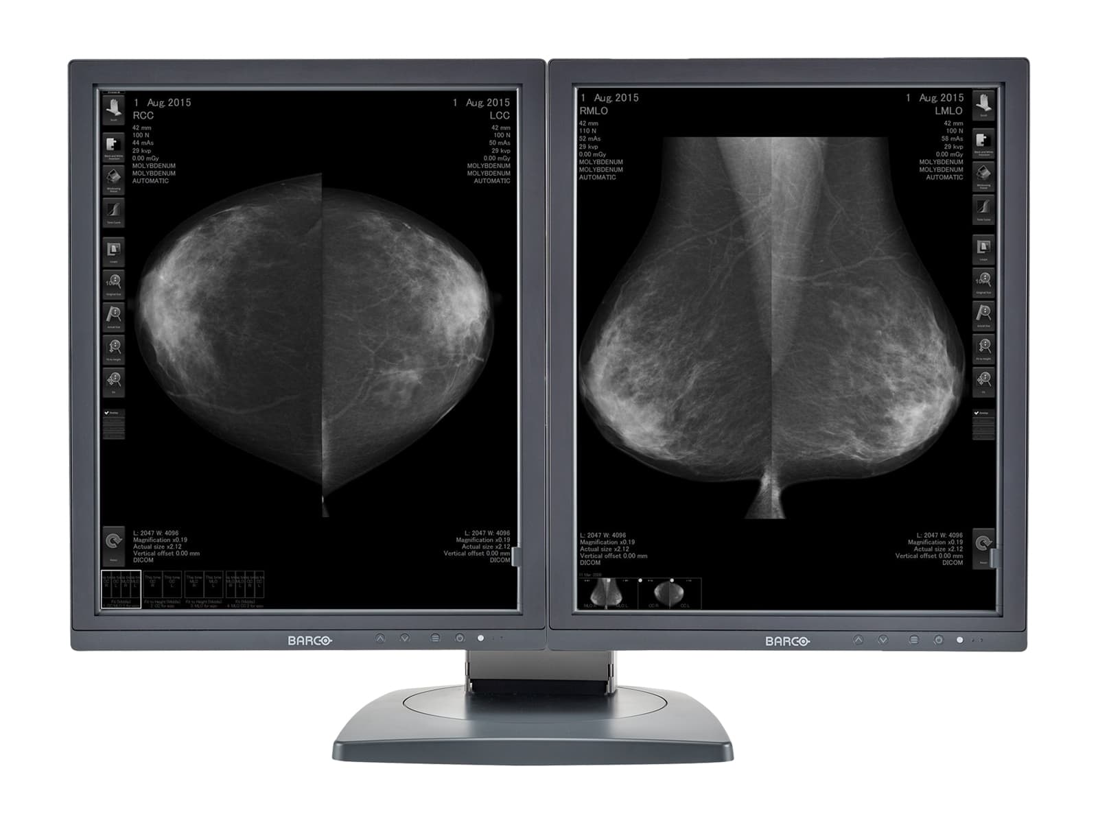 Complete Mammography Reading Station | Barco Display| HP Workstation