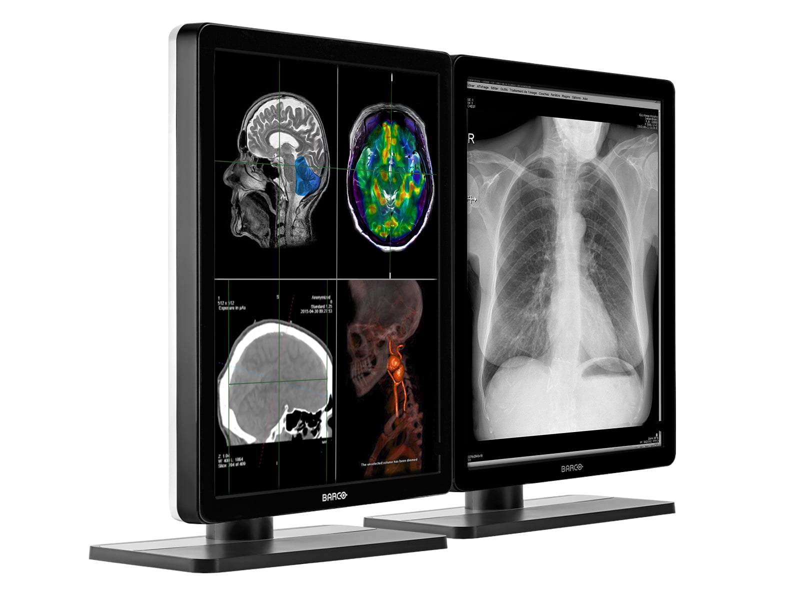 Barco Nio MDNC-2221 2MP 21" Color LED Diagnostic Radiology Display Monitor