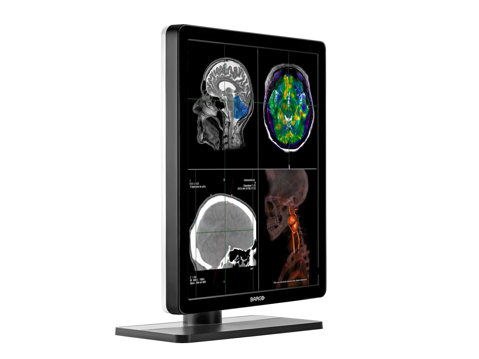 Barco Nio MDNC-2221 2MP 21" Color LED Diagnostic Radiology Display Monitor