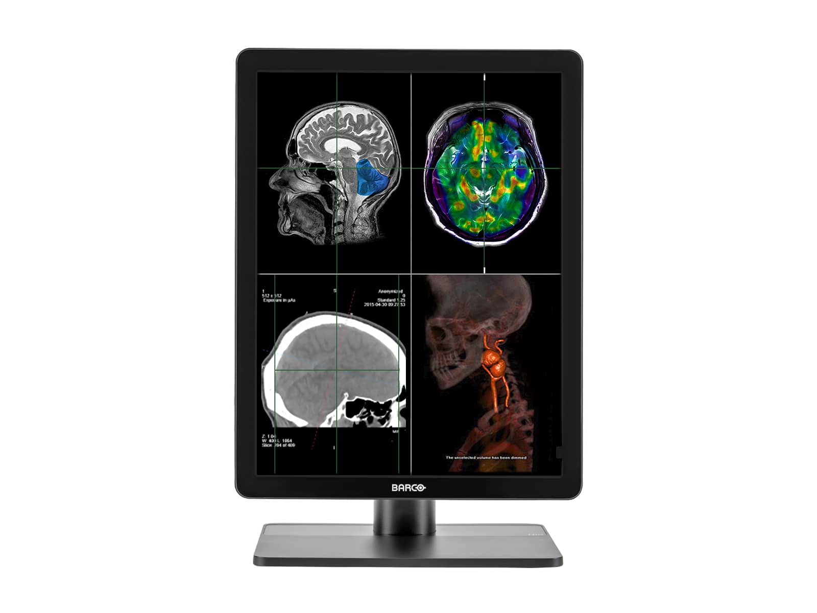 Barco Nio MDNC-3321 3MP 21" Color LED General Radiology Diagnostic PACS Display (Copy) Monitors.com 