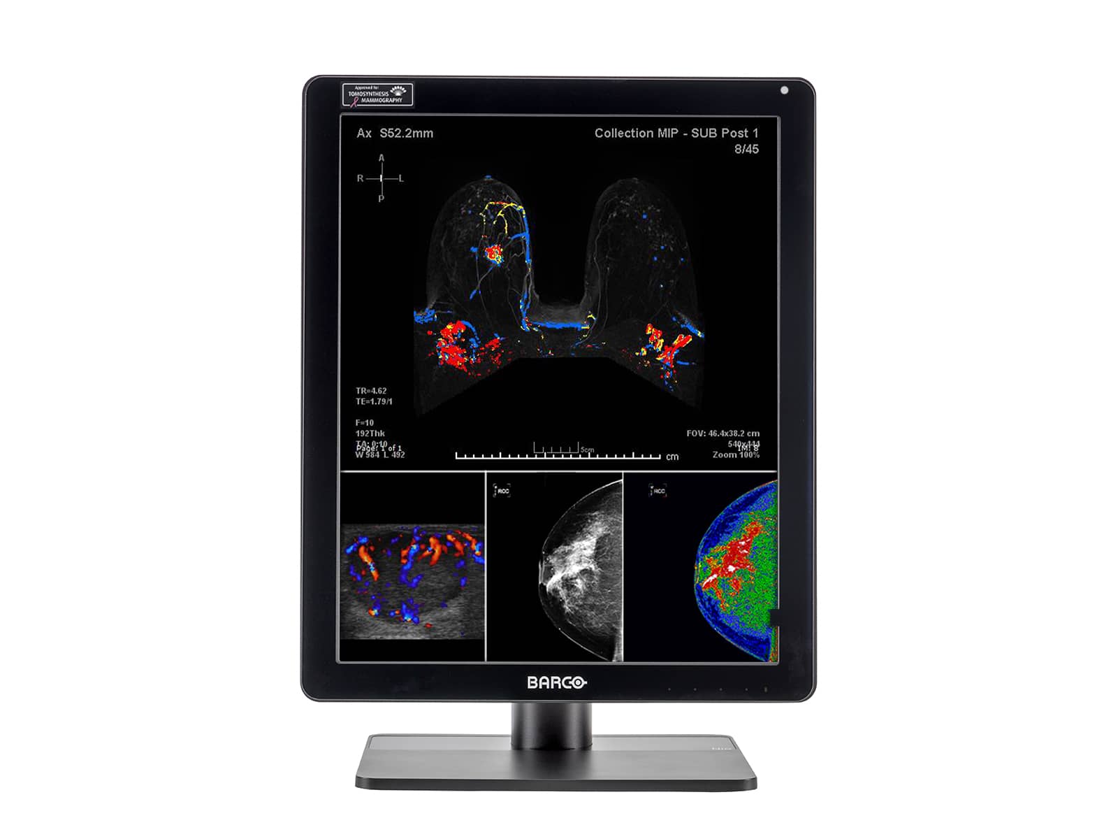 Barco Nio MDNC-6121 5MP 21" Color LED Mammo 3D-DBT Breast Imaging Display