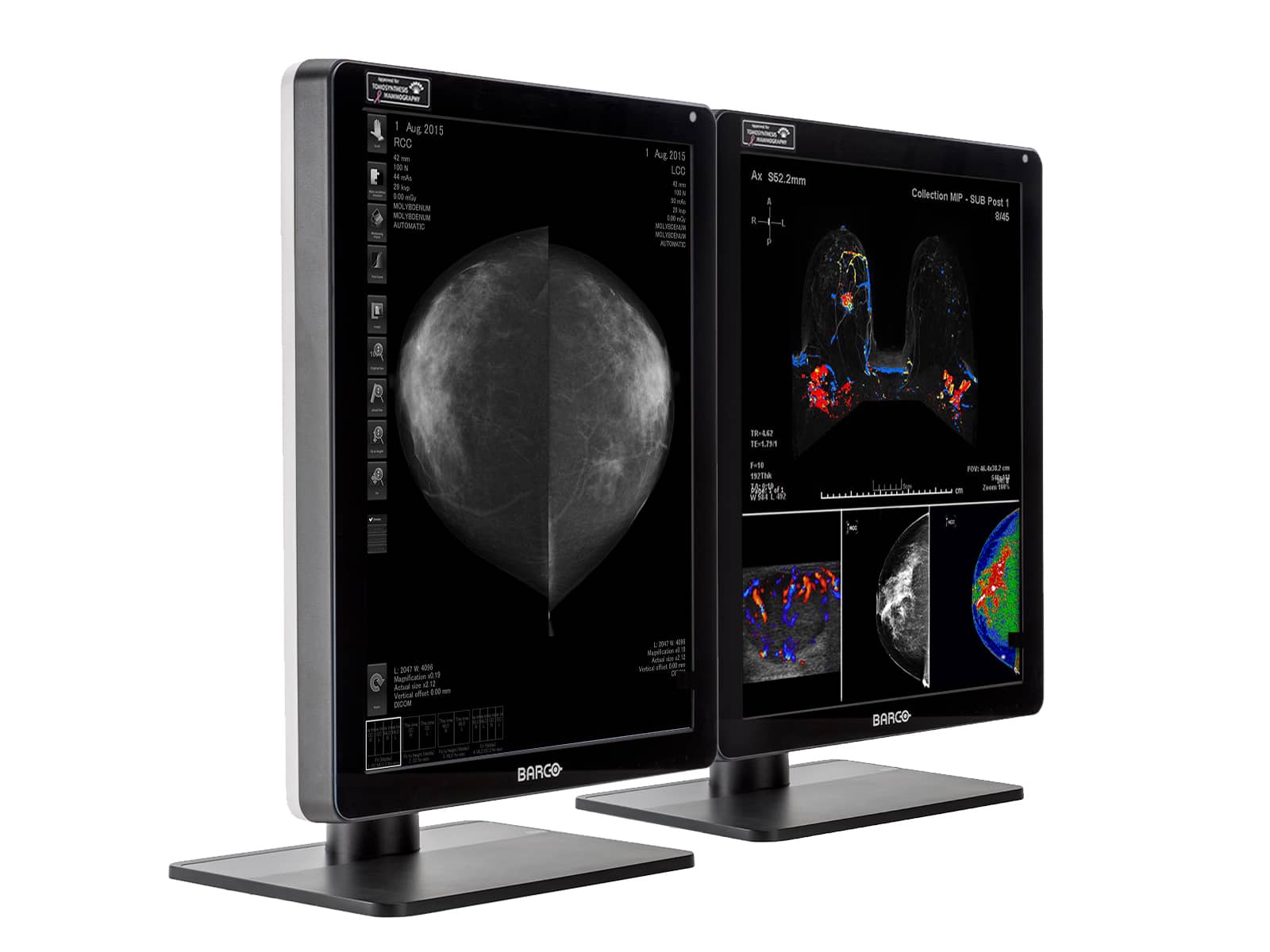 Barco Nio MDNC-6121 5MP 21" Color LED Mammo 3D-DBT Breast Imaging Display