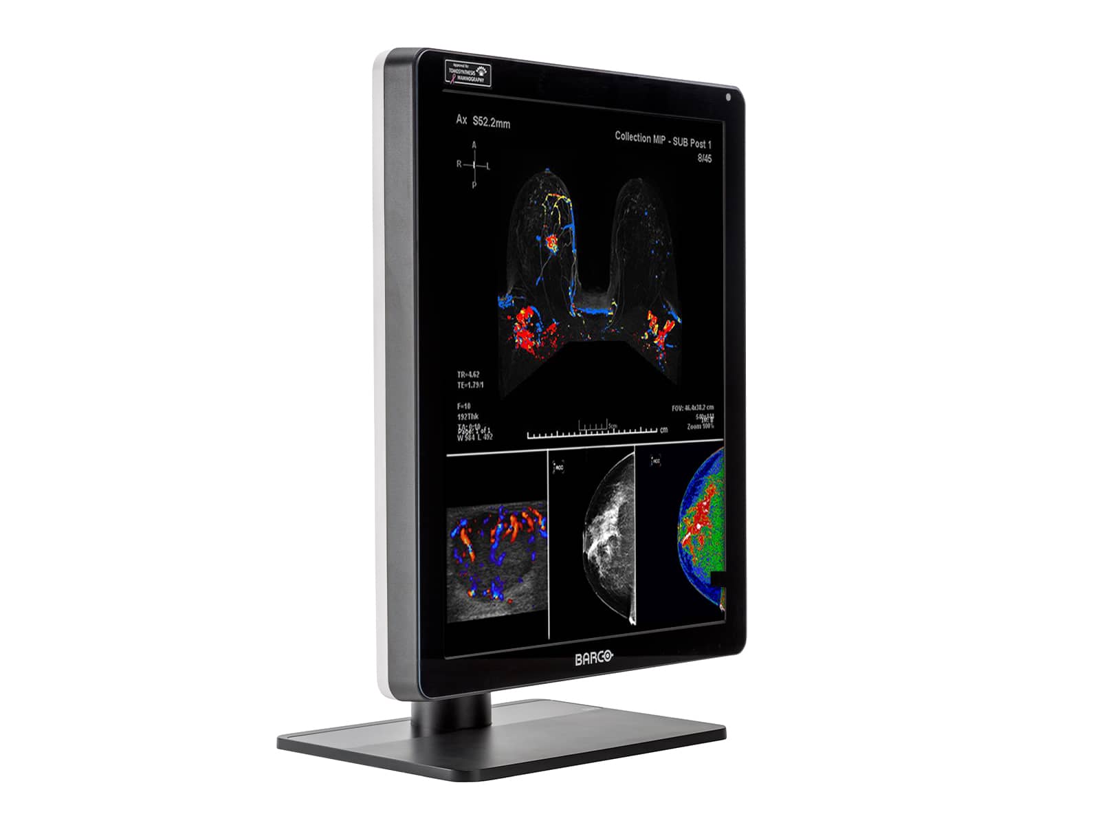 Barco Nio MDNC-6121 5MP 21" Color LED Mammo 3D-DBT Breast Imaging Display