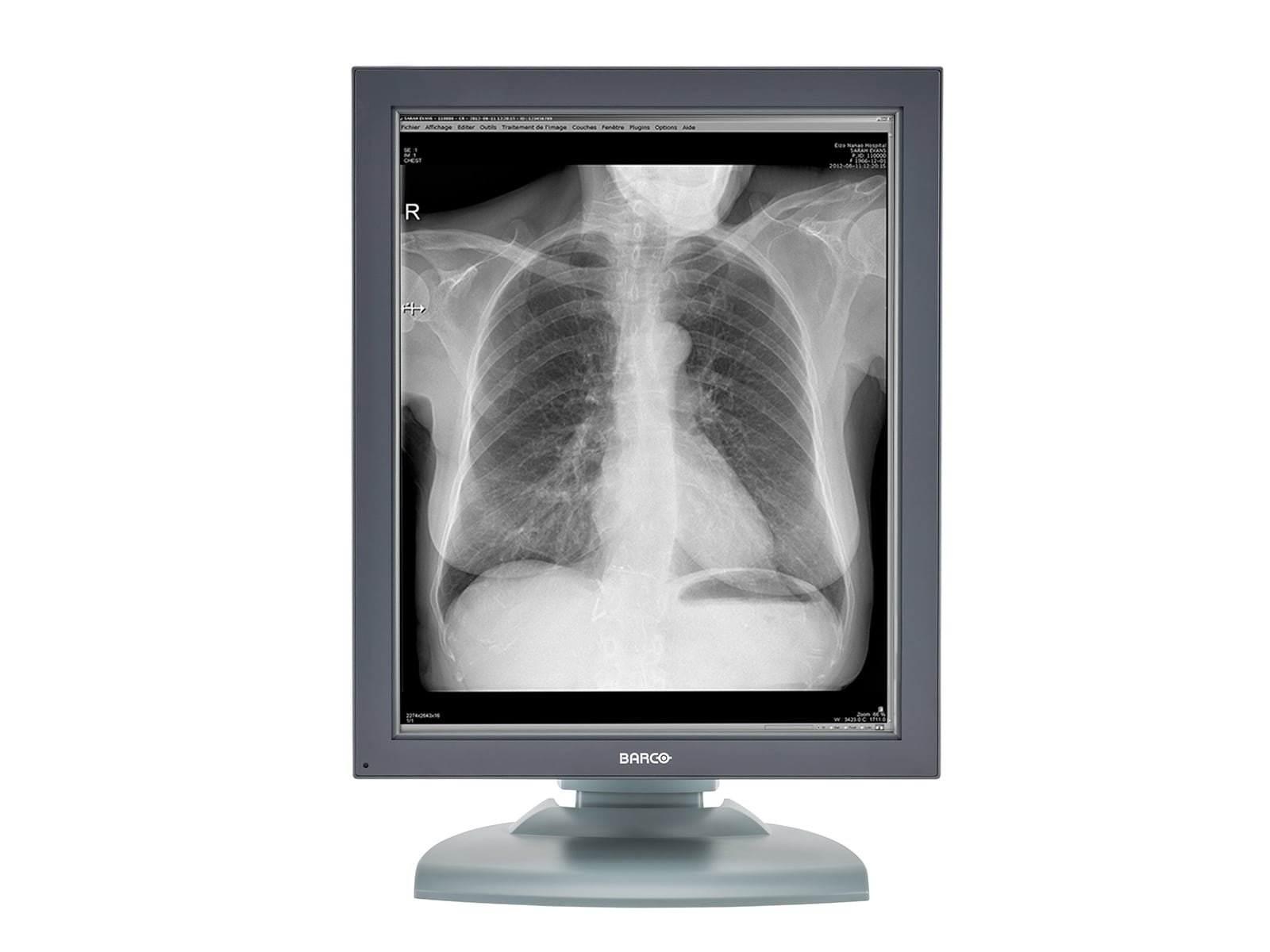 Barco Nio MDNG-2121 2MP 21" Grayscale Medical Diagnostic Radiology Monitor Monitors.com 