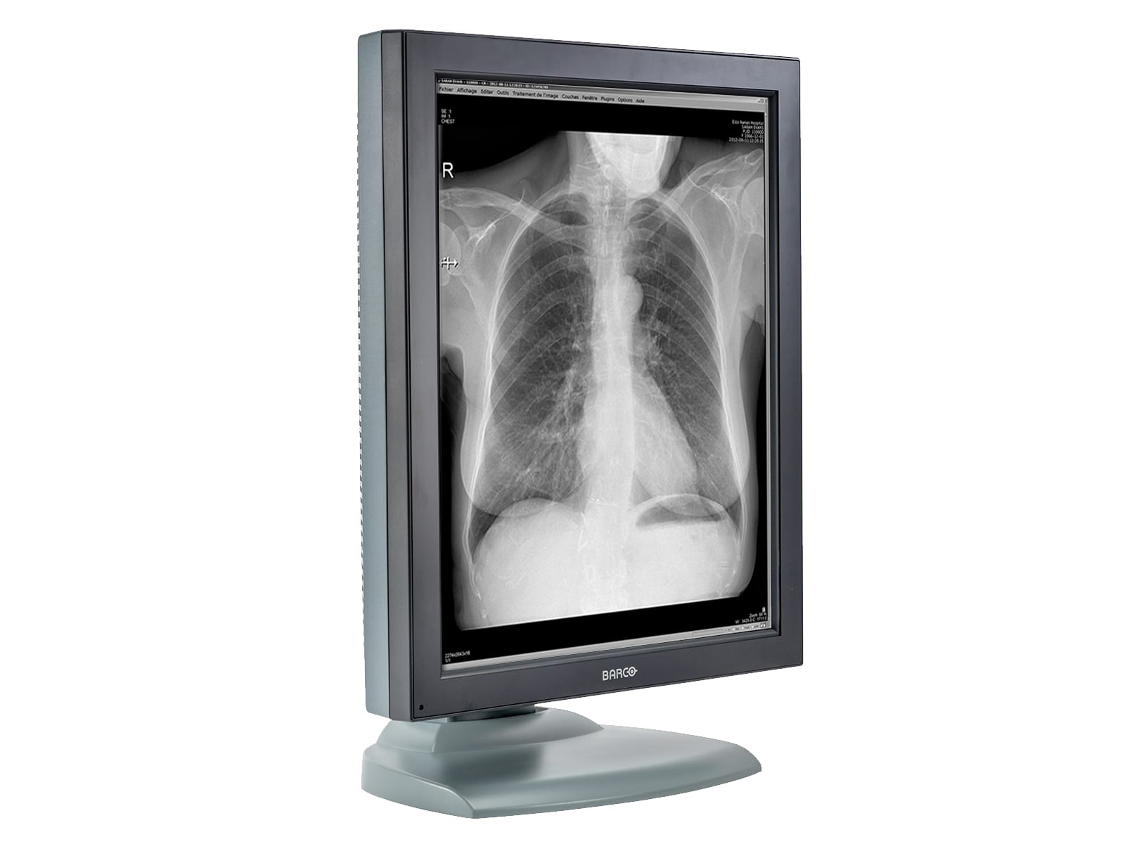 Barco Nio MDNG-2121 2MP 21" Grayscale Medical Diagnostic Radiology Monitor Monitors.com 