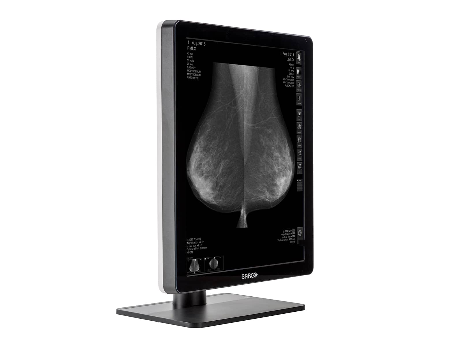 Barco Nio MDNG-5221 5MP 21" Grayscale LED 3D-DBT Mammography Breast Imaging PACS Display