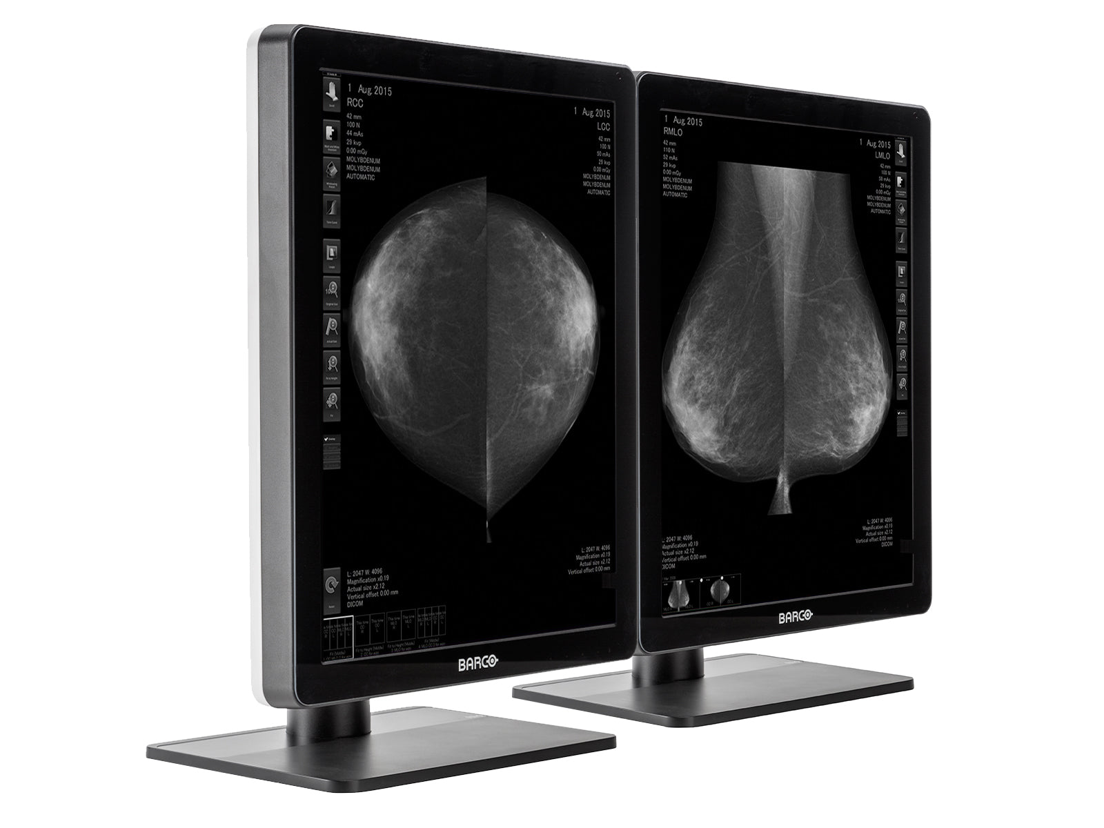 Complete Mammography Reading Station | Barco 5MP Grayscale LED Monitor | Lenovo Workstation | Dictation Mic | Worklist Monitors (QNG5221Z4R)