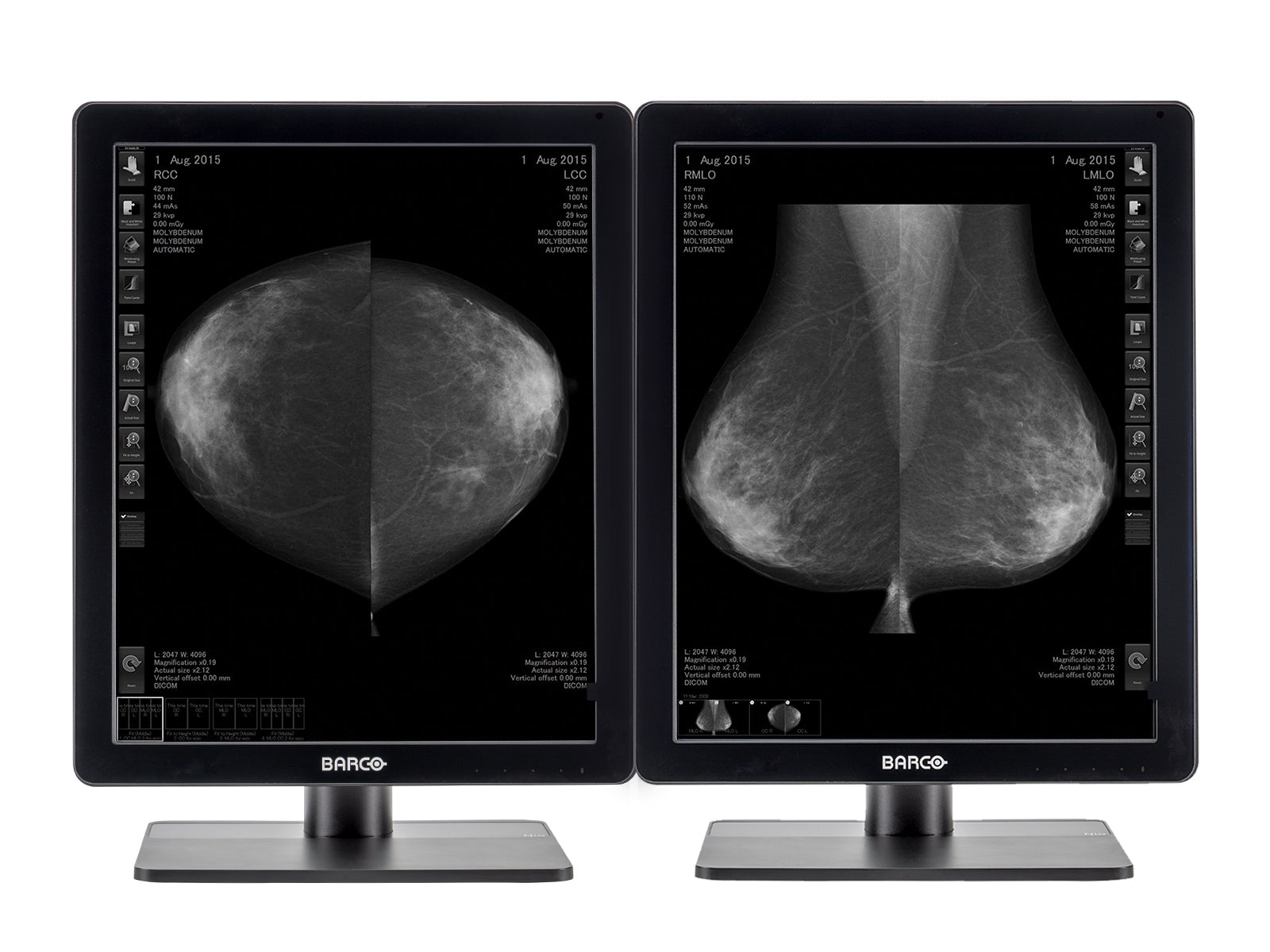 Complete Mammography Reading Station | Barco 5MP Grayscale LED Monitor | Lenovo Workstation | Dictation Mic | Worklist Monitors (QNG5221Z4R)