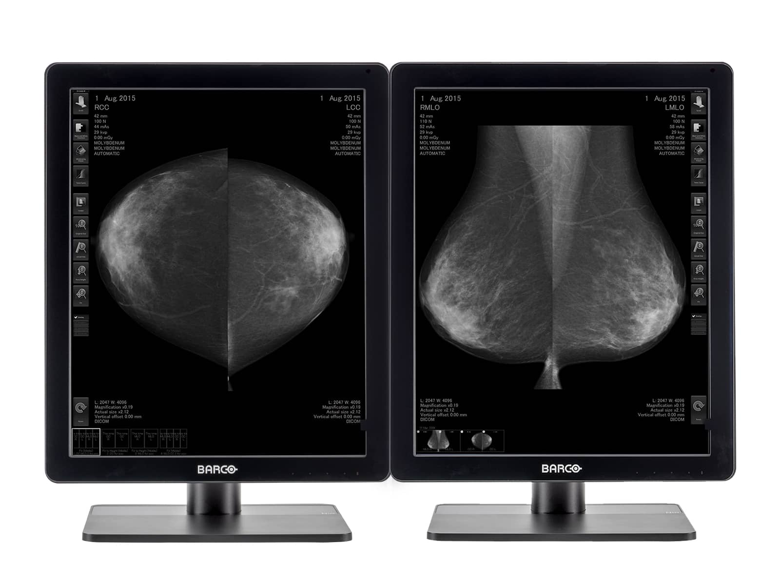 Barco Nio MDNG-5221 5MP 21" Grayscale LED 3D-DBT Mammography Breast Imaging PACS Display