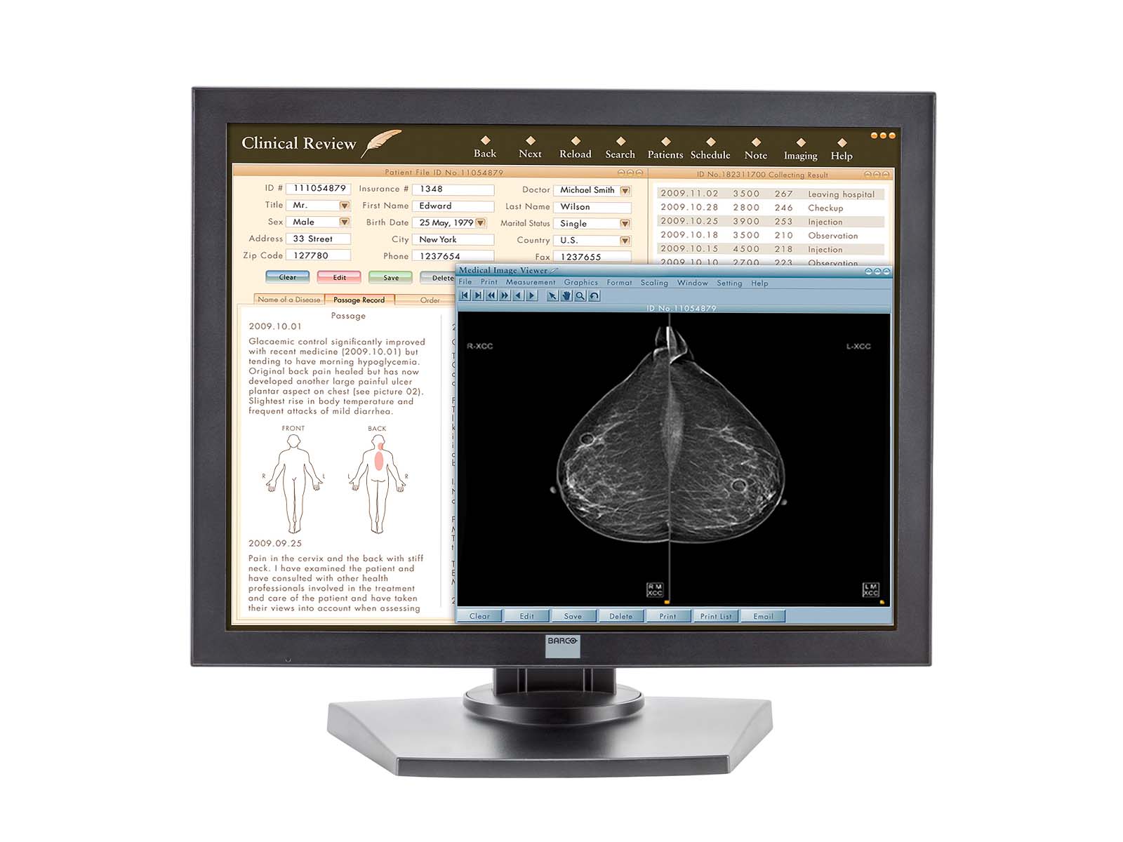 Complete PACS Mammography Reading Station | Barco 5MP Grayscale Displays | Lenovo Workstation | Dictation Mic | Worklist Monitor (MG5121Z4R)