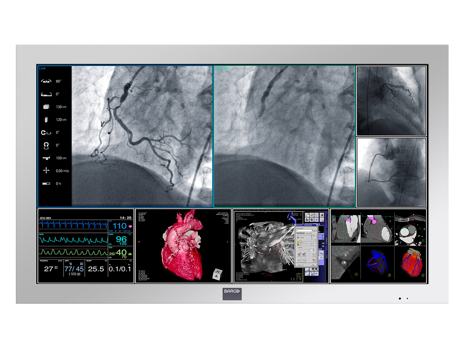 Barco MDSC-2242 42" 2MP Full HD Color Surgical Medical Display Monitor (K9307914)