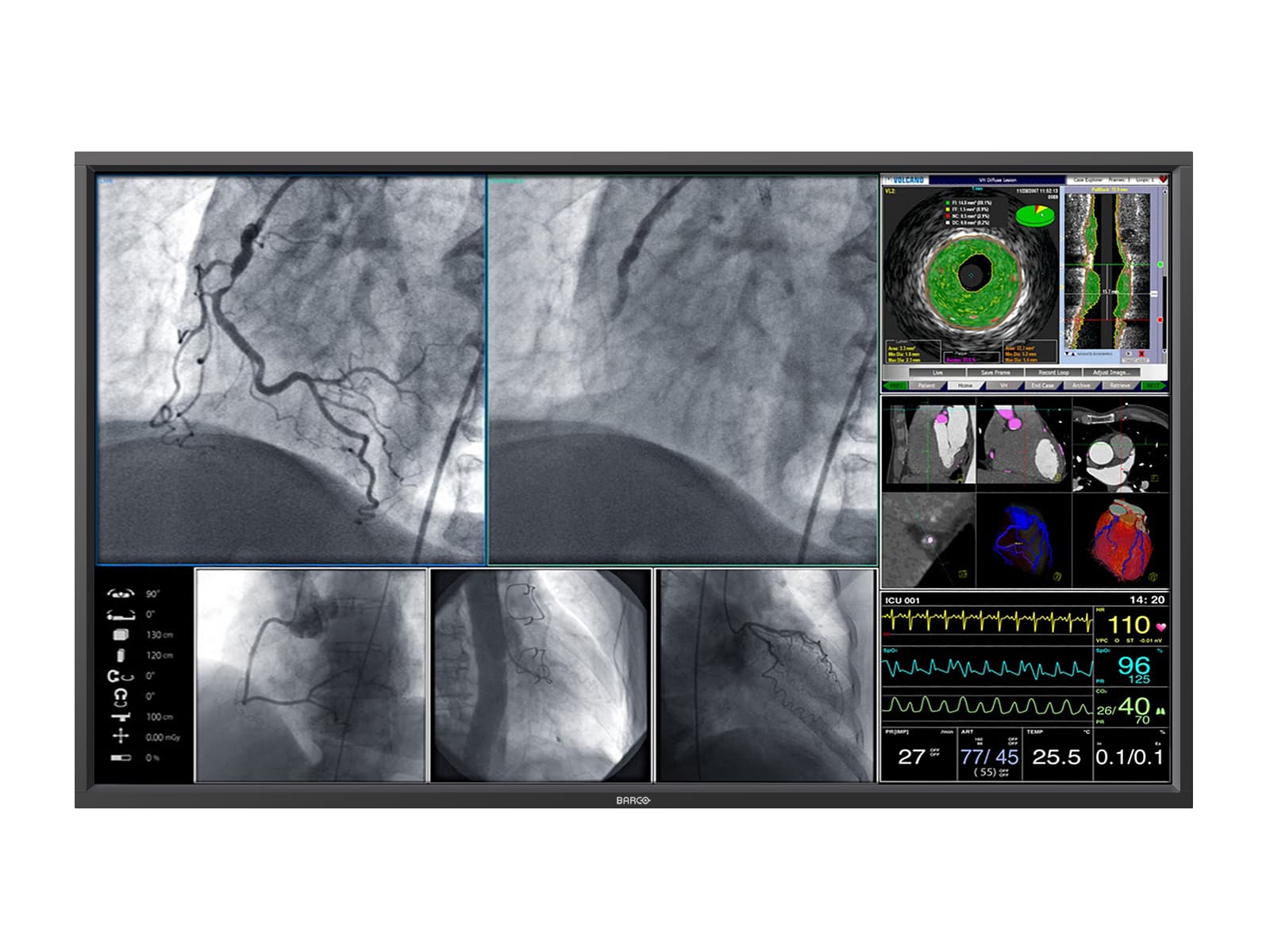 Barco Steris MDSC-8258 RLG 58" 8MP 4K Color Surgical Medical Display Monitor (K9307852 / RBDV58MG8MP) Monitors.com 