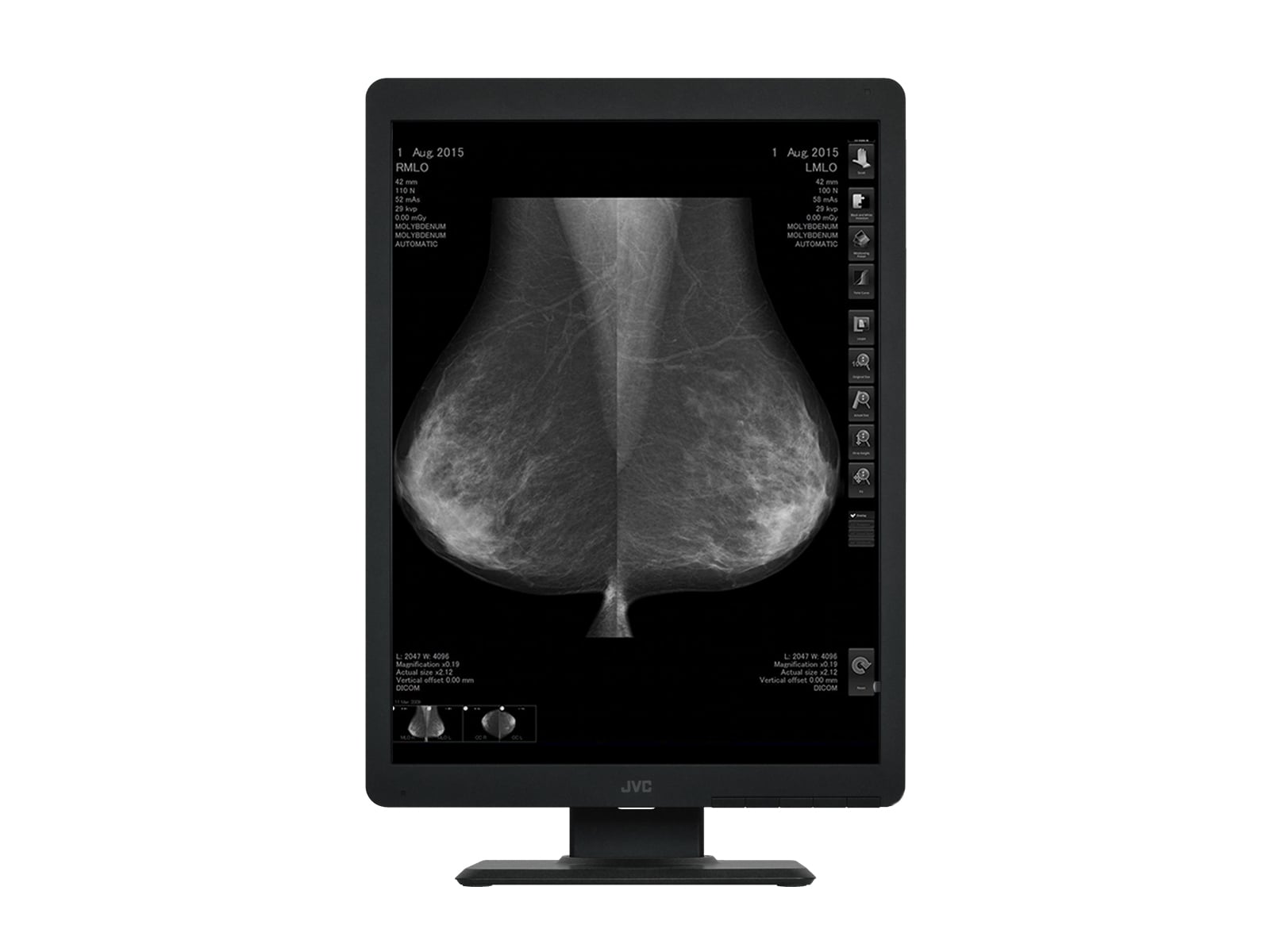 Vidar CAD Pro Advantage Mammography Film Digitizer (15790-002)