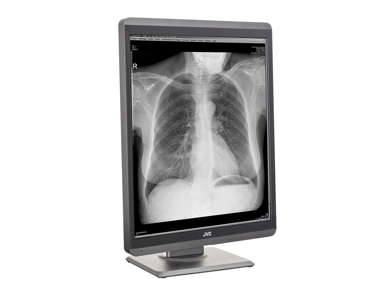 JVC Totoku MS-S300 3MP 21" LED Grayscale General Radiology Diagnostic Display Monitor (MS-S300) Monitors.com 