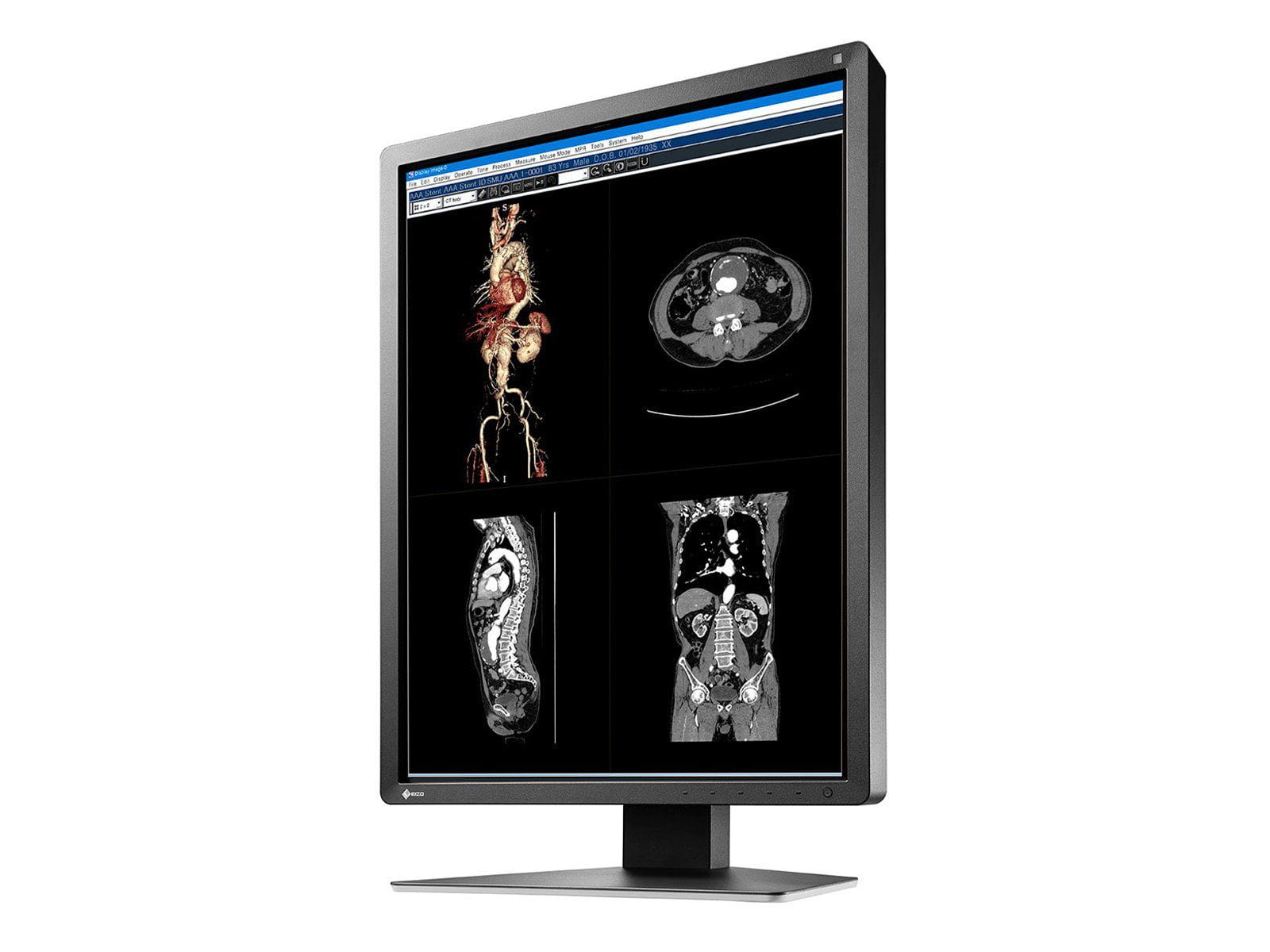 Eizo RadiForce MX216 2MP 21" Color LED Medical Display Monitor (MX216-BK) Monitors.com 