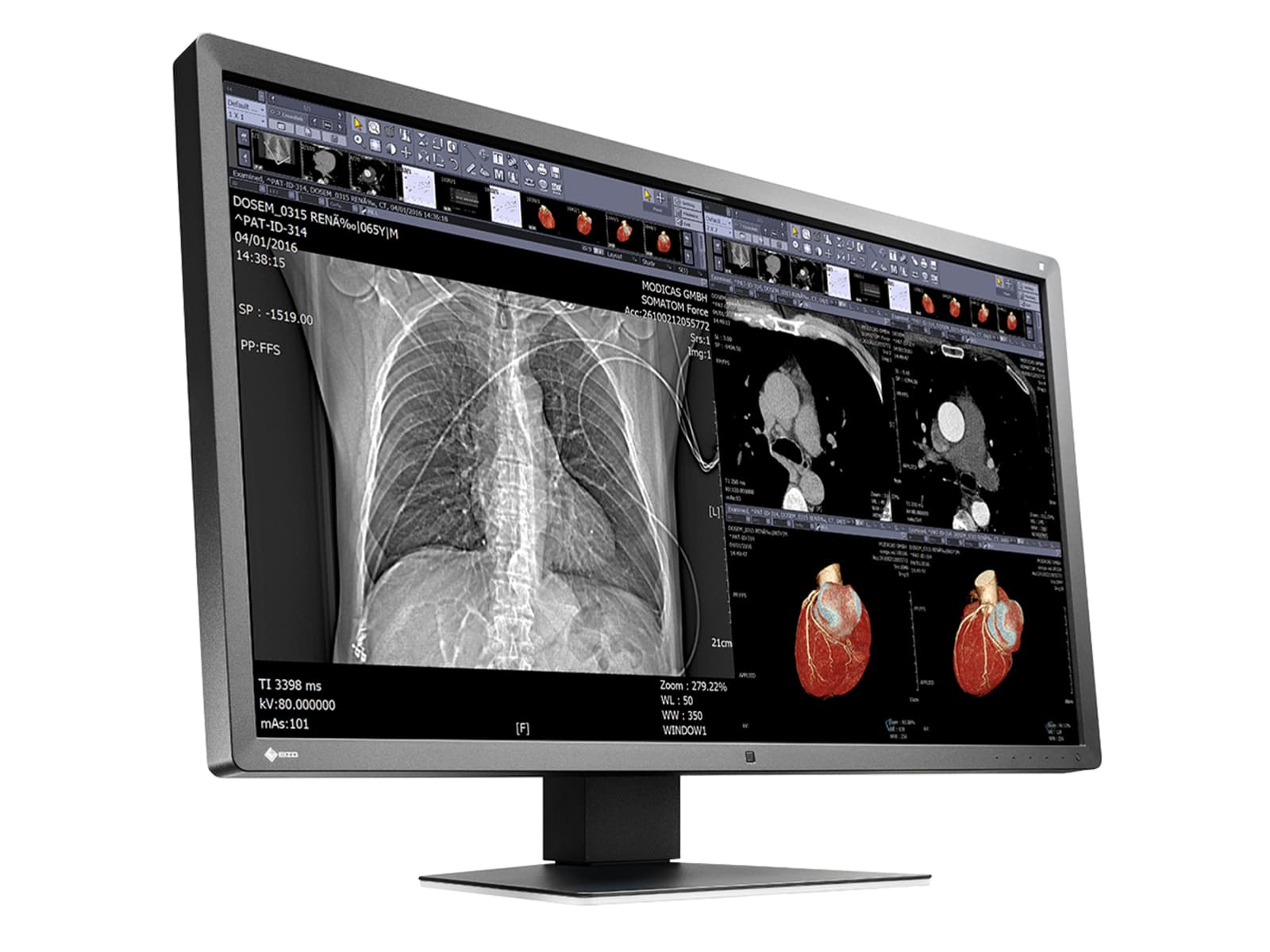 Eizo RadiForce MX315W 8MP 31" Color Clinical Review Display Monitor (MX315W-BK)