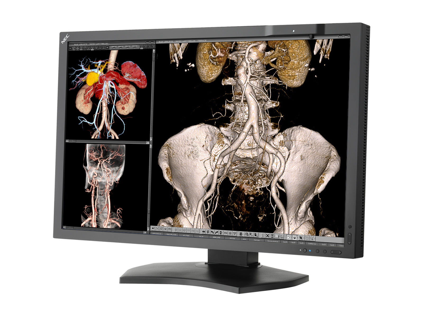 NEC MultiSync MD302C4 4MP 30" General Radiology PACS Display (MD302C4) Monitors.com 