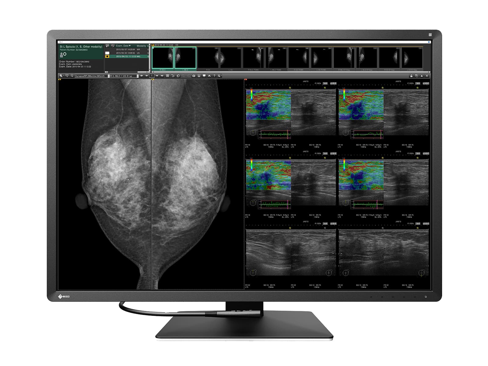 Complete Mammography Reading Station | Eizo 12MP Color Display | HP Z4 G5 Workstation | Dictation Mic | Worklist Monitors (RX1270Z4G5) Monitors.com 