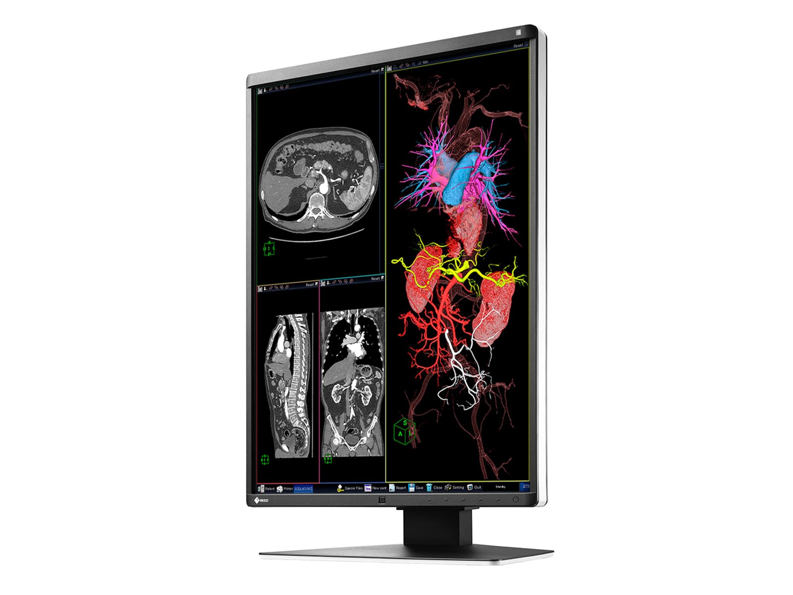 Eizo RadiForce RX350 3MP 21" Color LED General Radiology Diagnostic Display (RX350) Monitors.com 