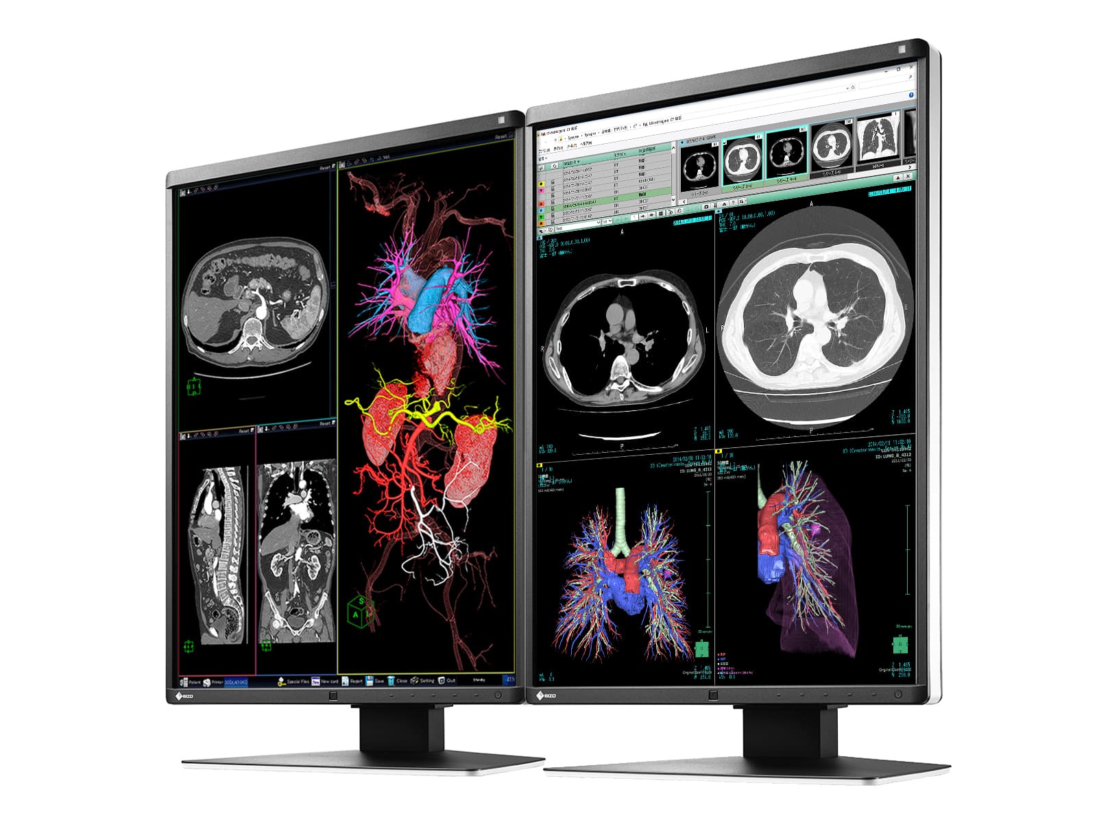 Eizo RadiForce RX360 3MP 21" Color LED General Radiology PACS Display Monitor (RX360)