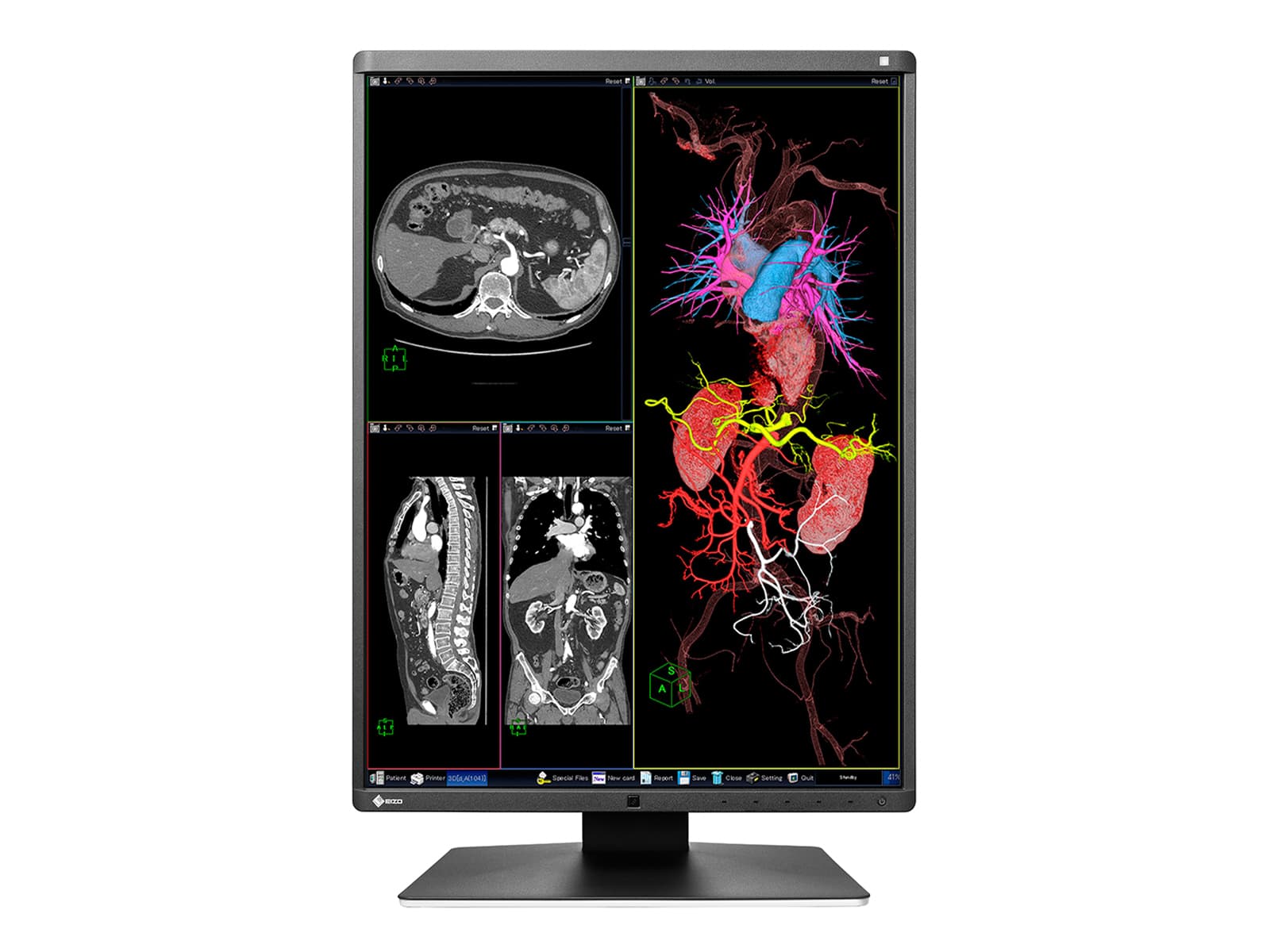 Eizo RadiForce RX360 3MP 21" Color LED General Radiology PACS Display Monitor (RX360)