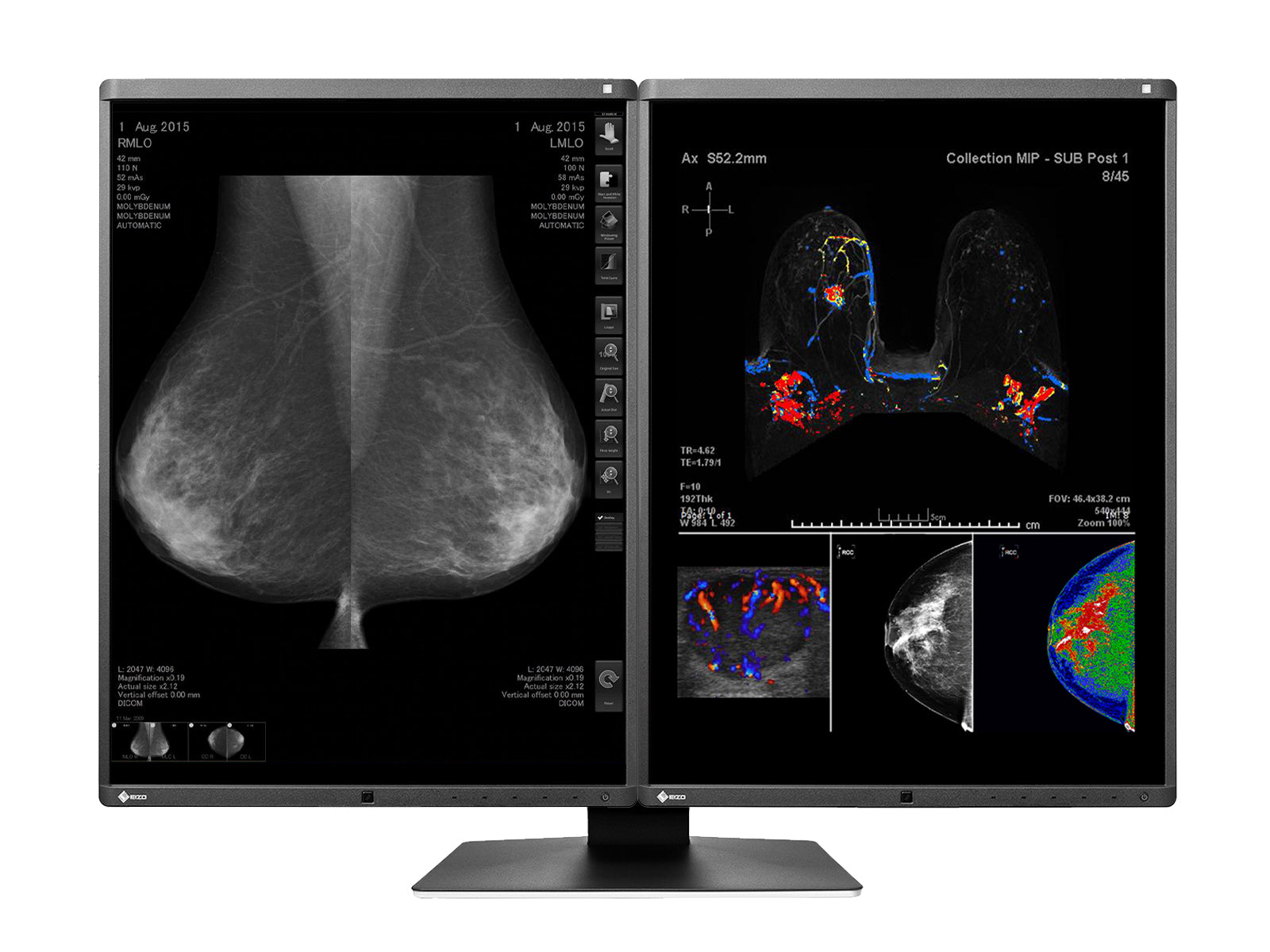 Eizo RadiForce RX560 5MP 21" Color LED Mammo 3D-DBT Breast Imaging Display (RX560-BK) Monitors.com 