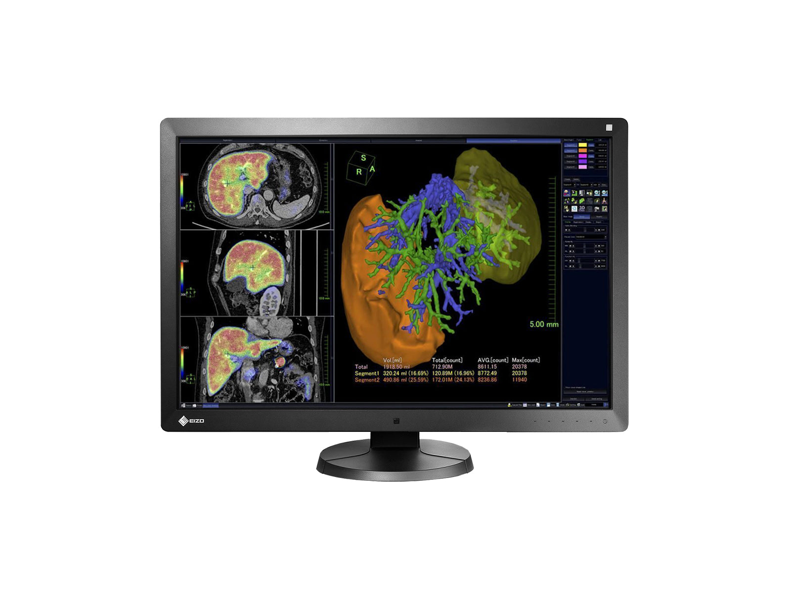 Complete PACS General Radiology Station | Eizo 6MP | HP Workstation