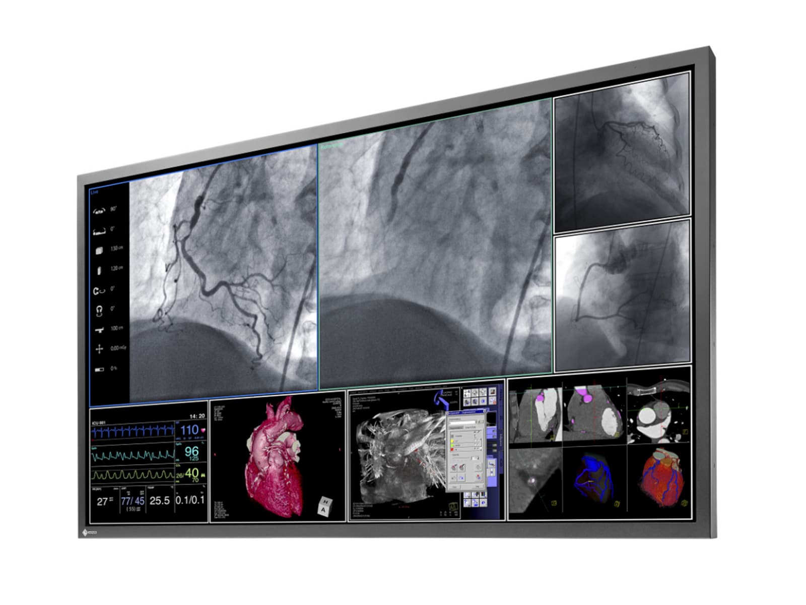 Eizo RadiForce LS580W 8MP 58" 4K Surgical Medical Display (LS580W)