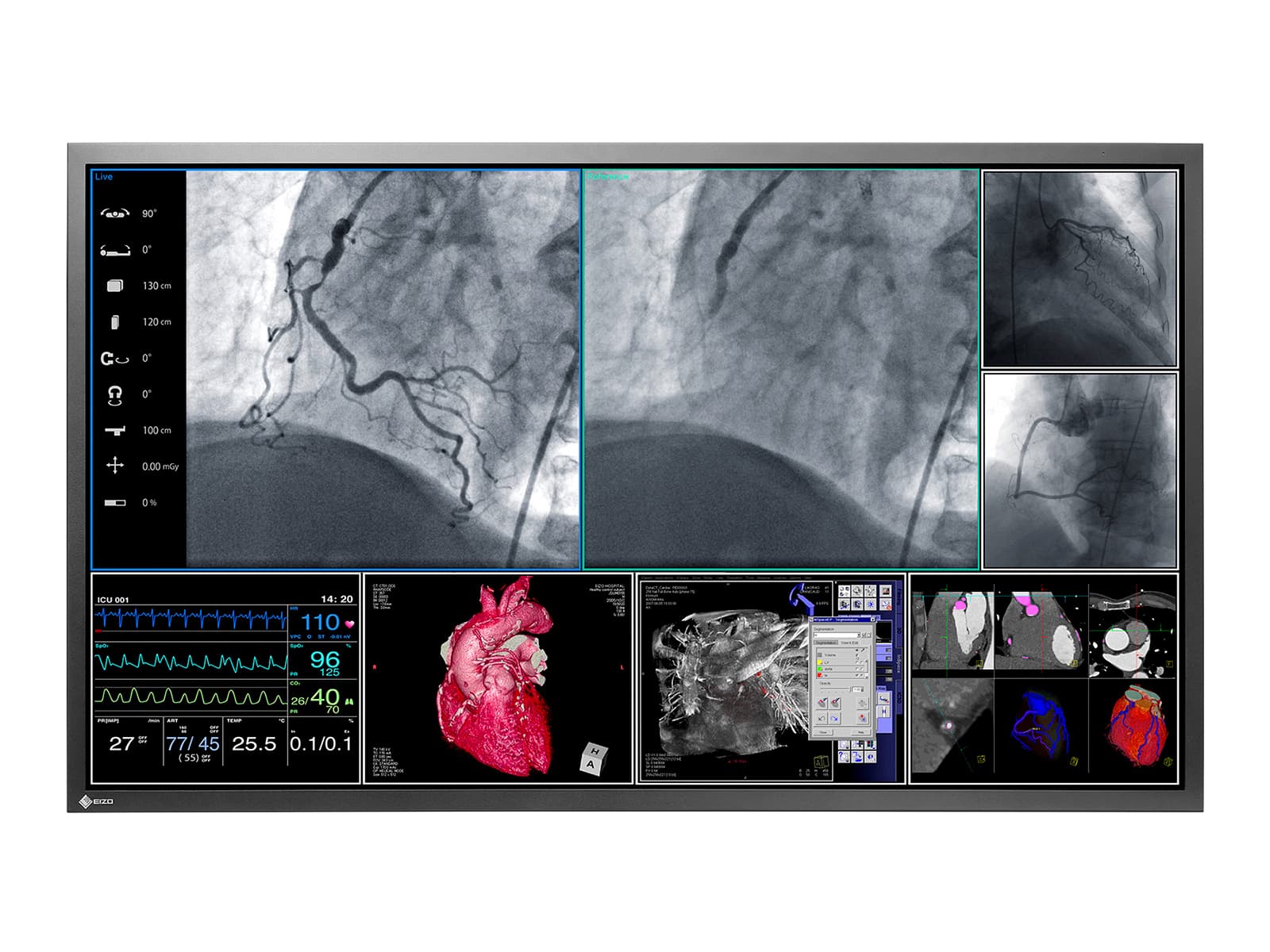 Eizo RadiForce LS580W 8MP 58" 4K Surgical Medical Display (LS580W) Monitors.com 