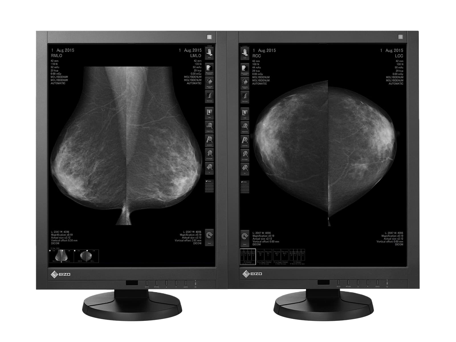 Eizo RadiForce GX540 5MP 21" Grayscale LED Digital Mammography 3D-DBT Display (GX540-CL) Monitors.com 