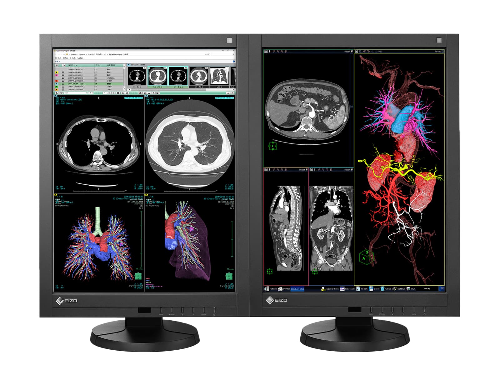 Eizo Radiforce RX340 3MP 21" Color LED General Radiology Diagnostic PACS Display (RX340-BK) Monitors.com 