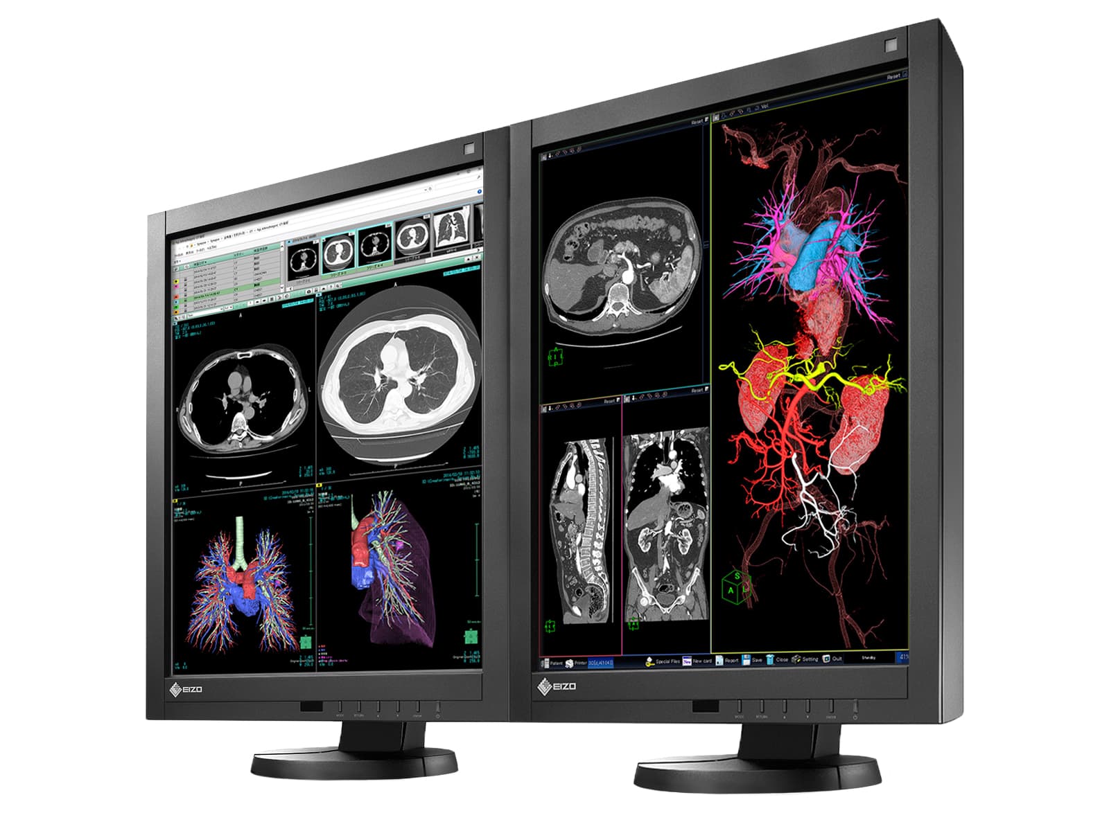 Eizo Radiforce RX340 3MP 21" Color LED General Radiology Diagnostic PACS Display (RX340-BK)