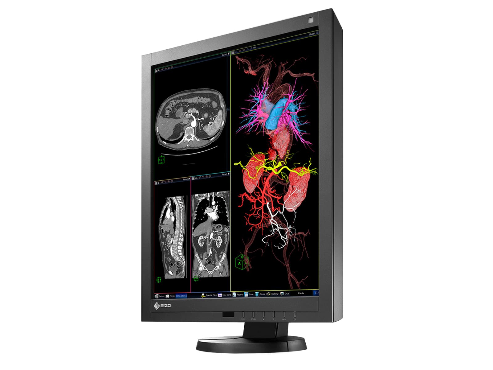 Eizo Radiforce RX340 3MP 21" Color LED General Radiology Diagnostic PACS Display (RX340-BK)