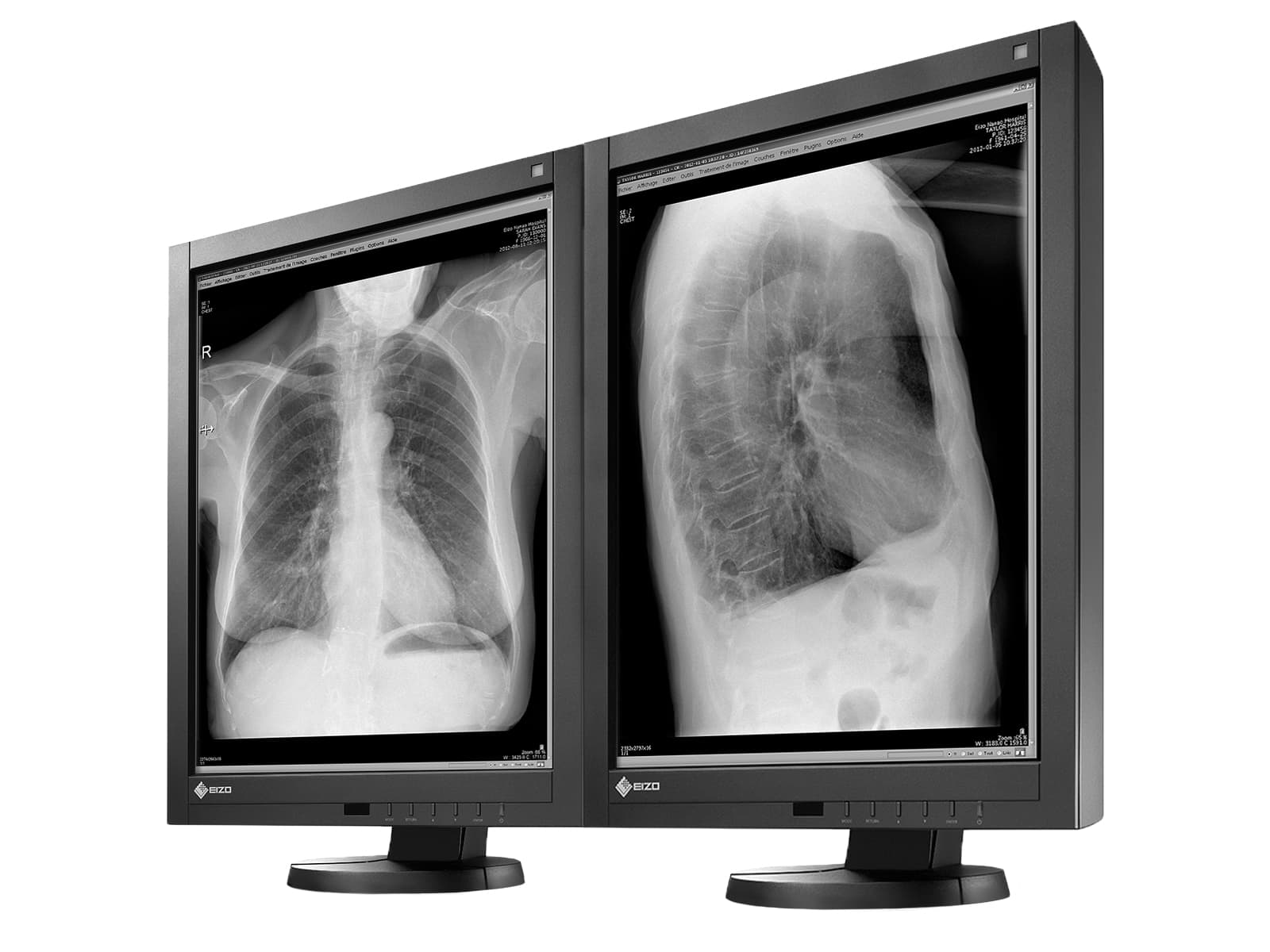 Eizo Radiforce GX240 21" 2MP Grayscale LED PACS Display Monitor (GX240) Monitors.com 