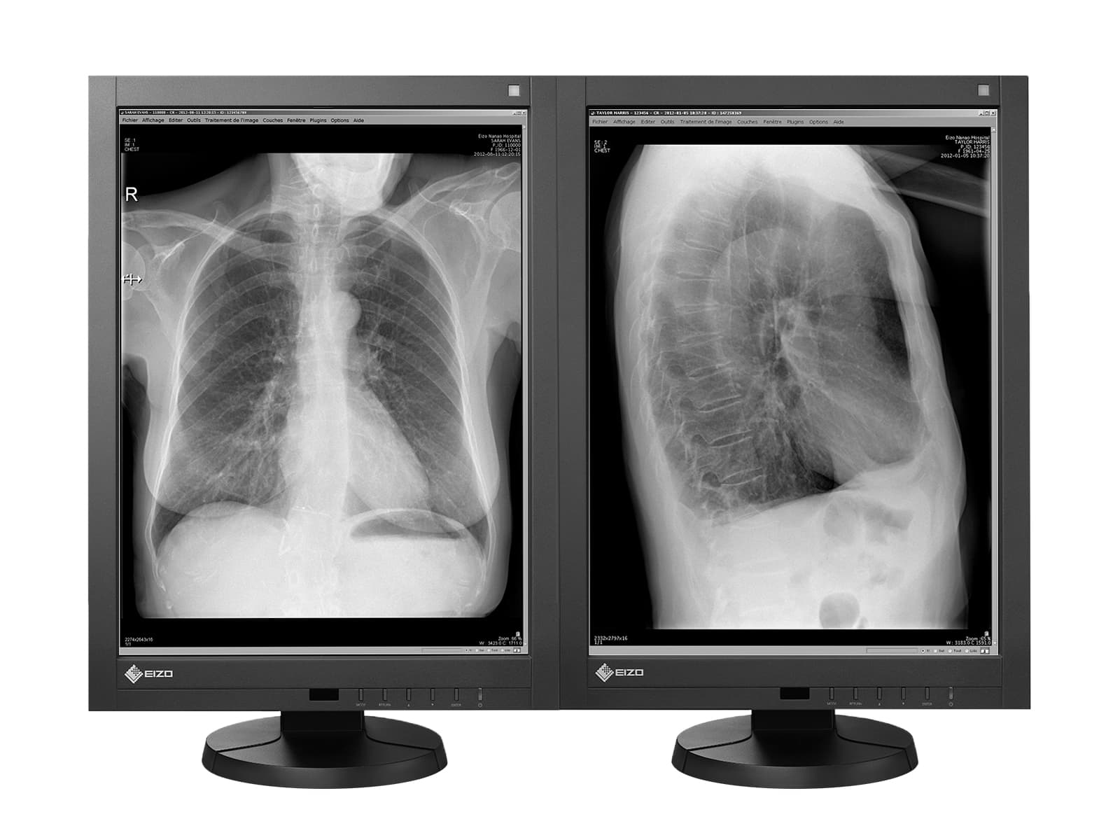 Eizo RadiForce GX340 3MP 21" Grayscale LED General Radiology Diagnostic Display Monitor (GX340-CL)