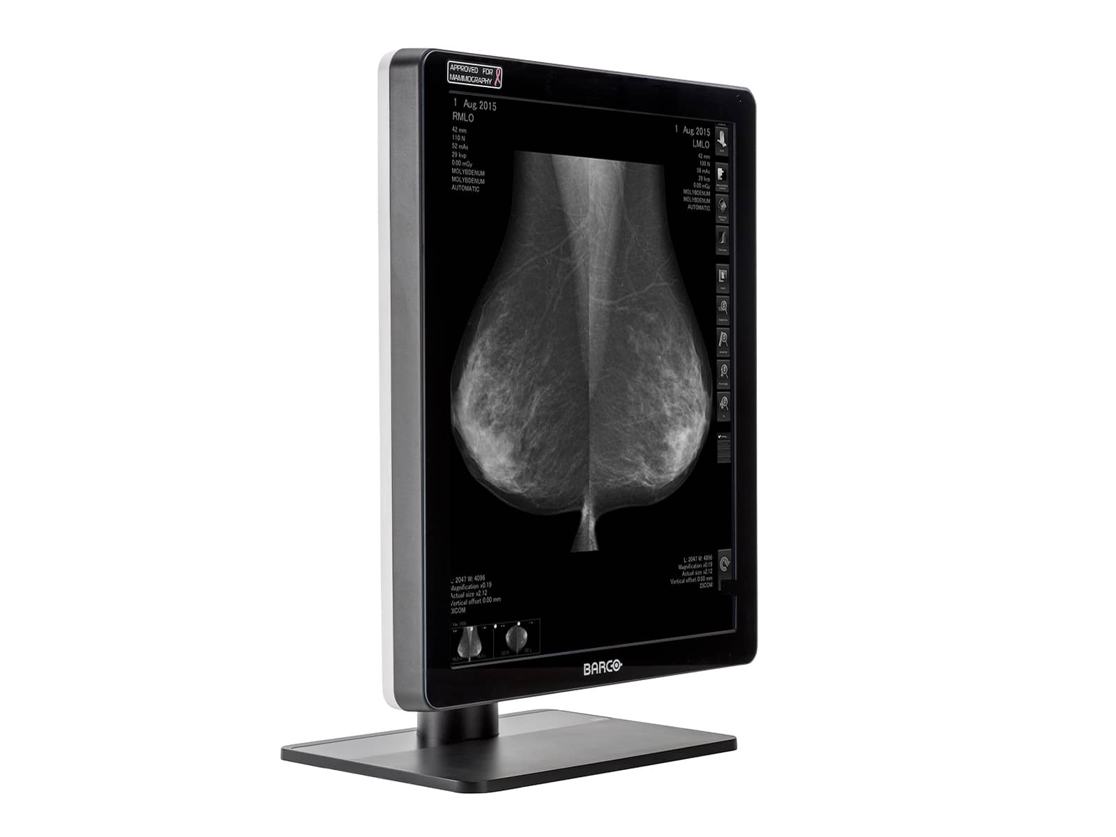 Barco Coronis MDCG-5221 5MP 21" Grayscale LED Mammo 3D-DBT Breast Imaging Display