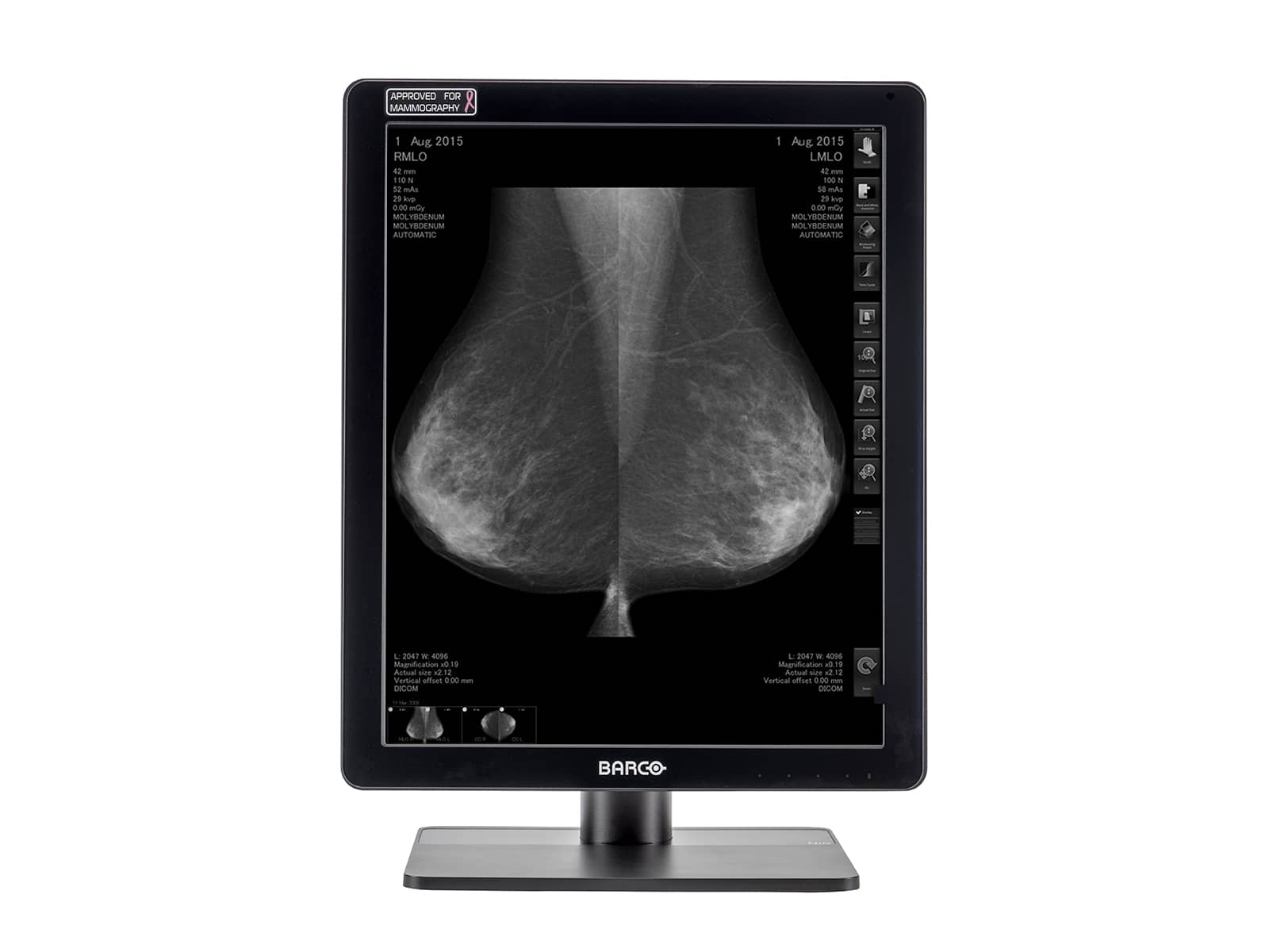 Barco Coronis MDCG-5221 5MP 21" Grayscale LED Mammo 3D-DBT Breast Imaging Display