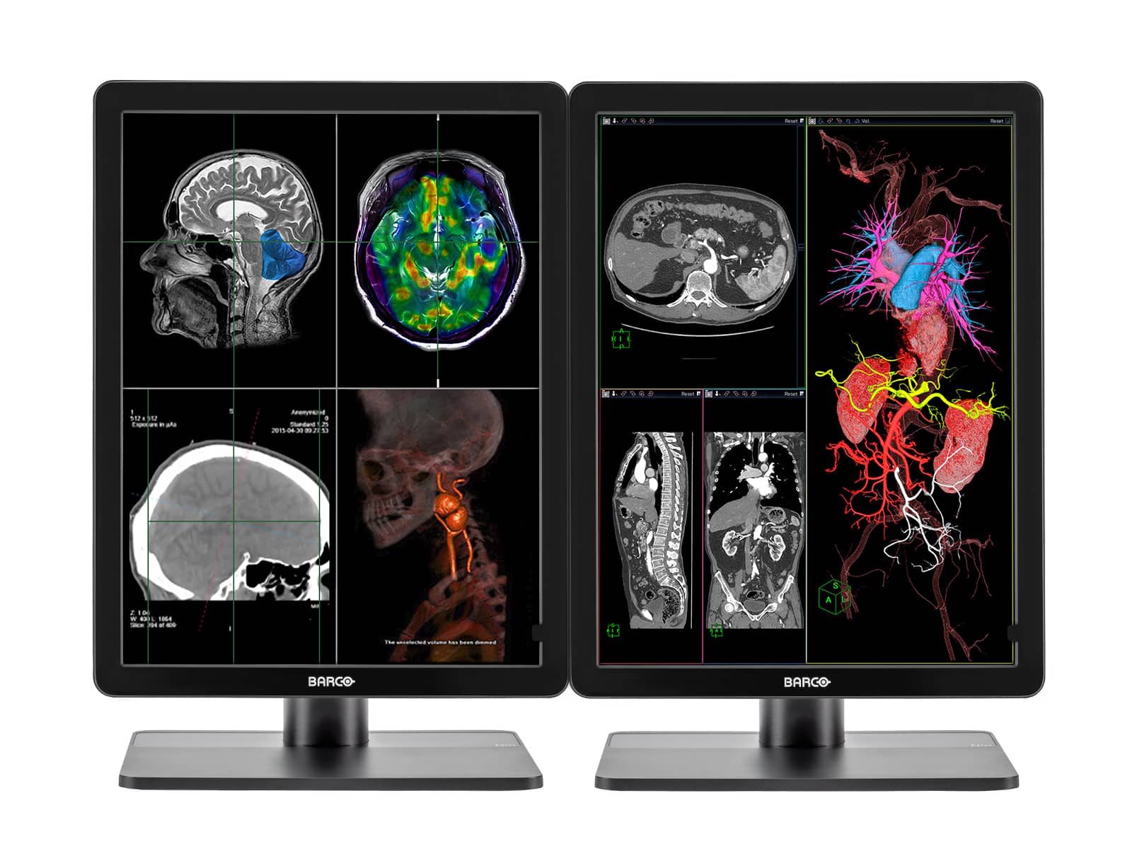 Complete PACS General Radiology Station | Barco 3MP Color LED Displays | Lenovo Workstation | Dictation Mic | Worklist Monitor (3421Z4R)