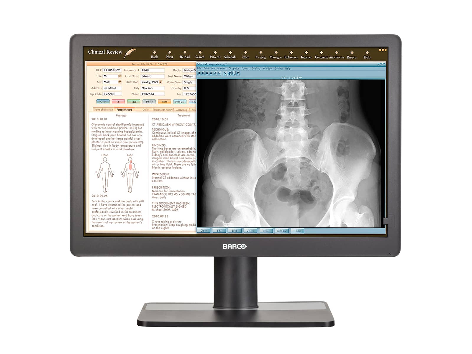 Barco Eonis MDRC-2222 Full HD 1080P 22" 2MP Clinical Review LED Monitor Monitors.com 