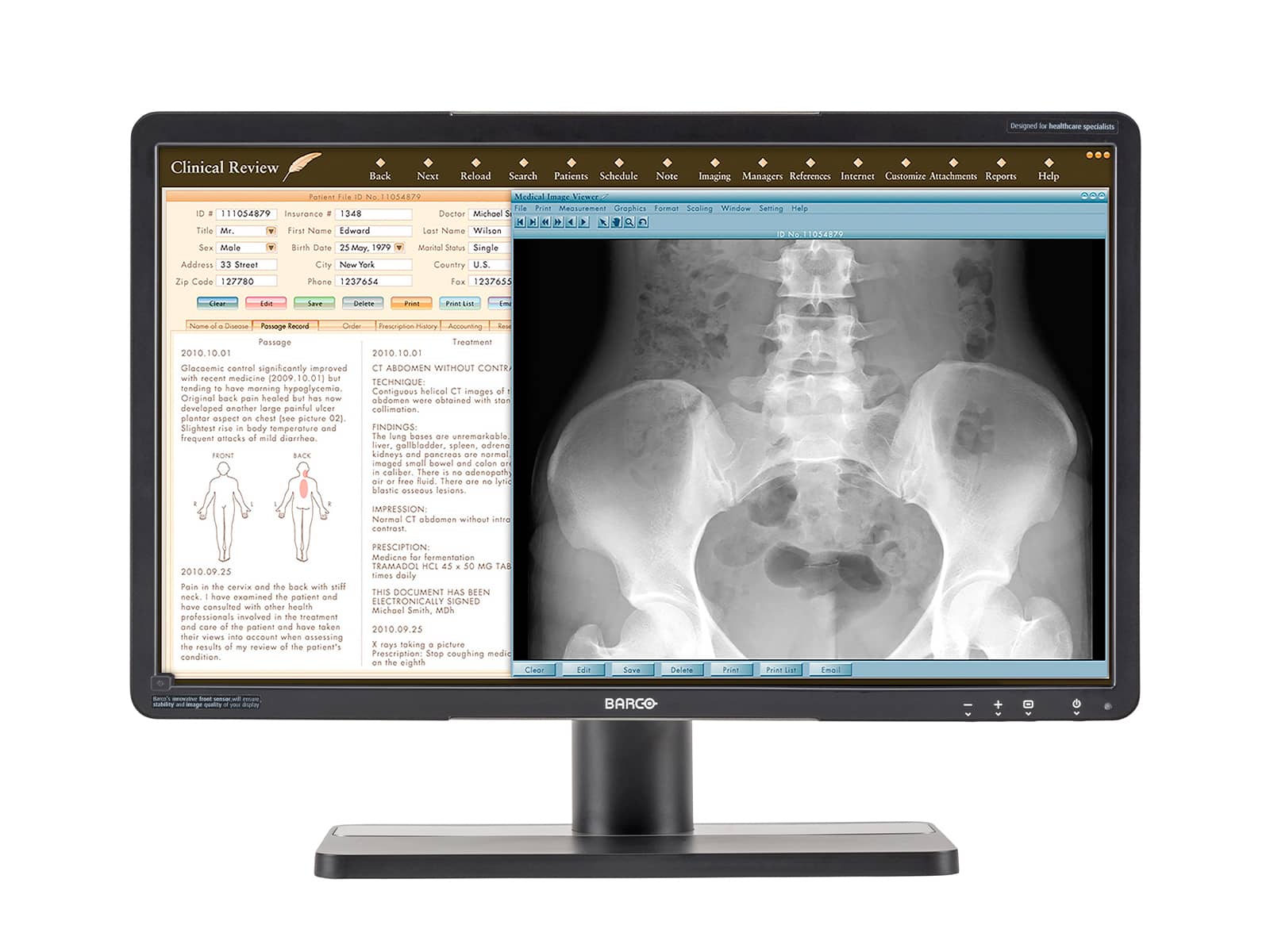 Barco Eonis MDRC-2224 WUXGA 24" 2MP Color LED Clinical Review Display Monitor