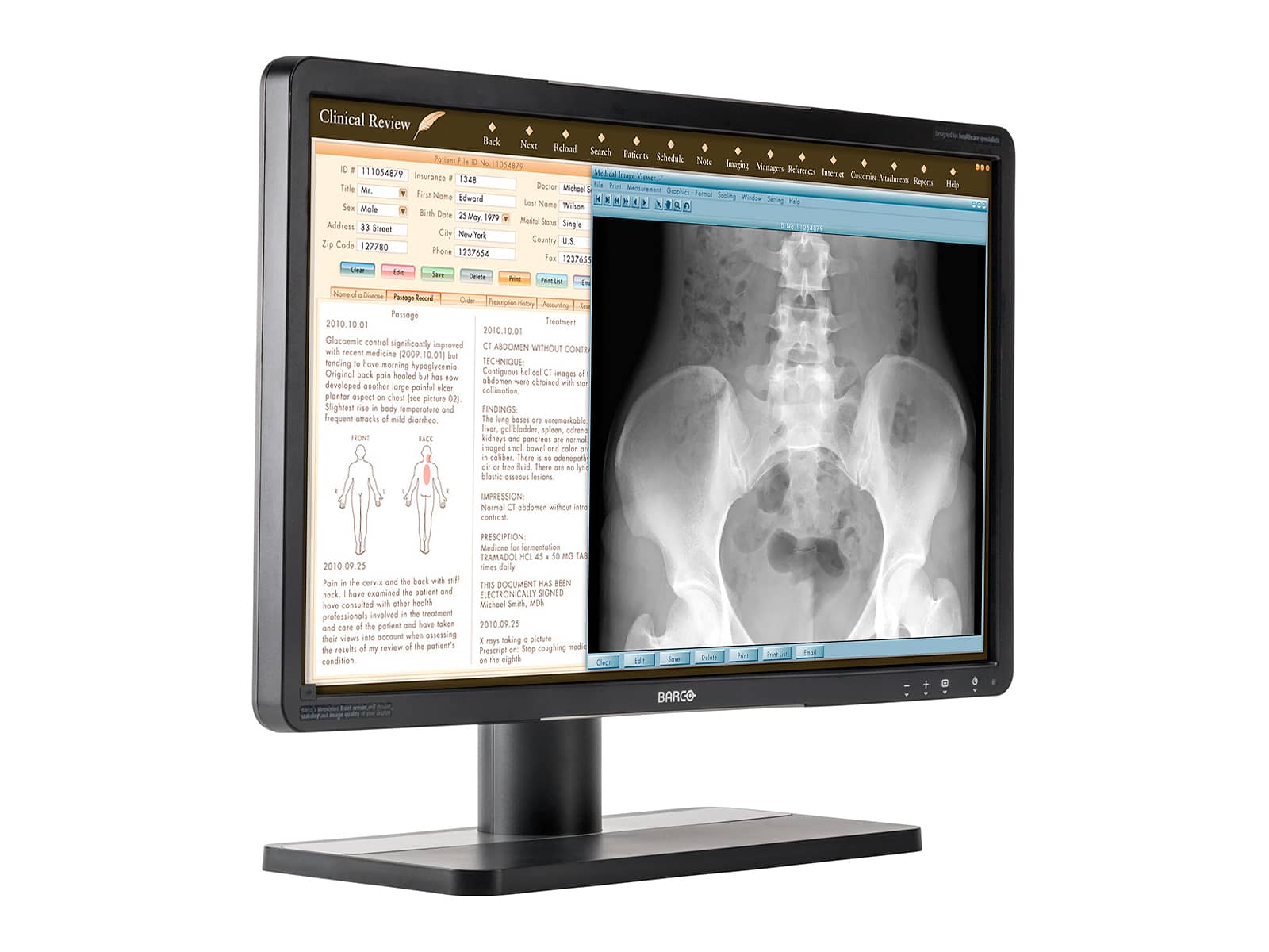 Barco Eonis MDRC-2224 WUXGA 24" 2MP Color LED Clinical Review Display Monitor